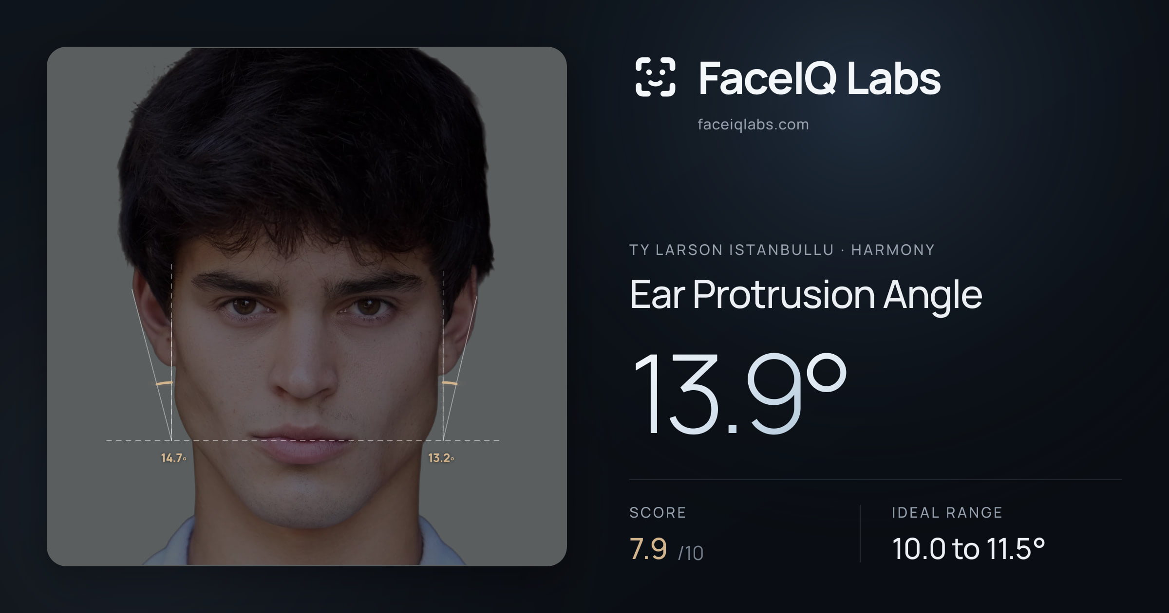 Ty Larson Istanbullu Ear Protrusion Angle: 13.9°, drawn on the photo