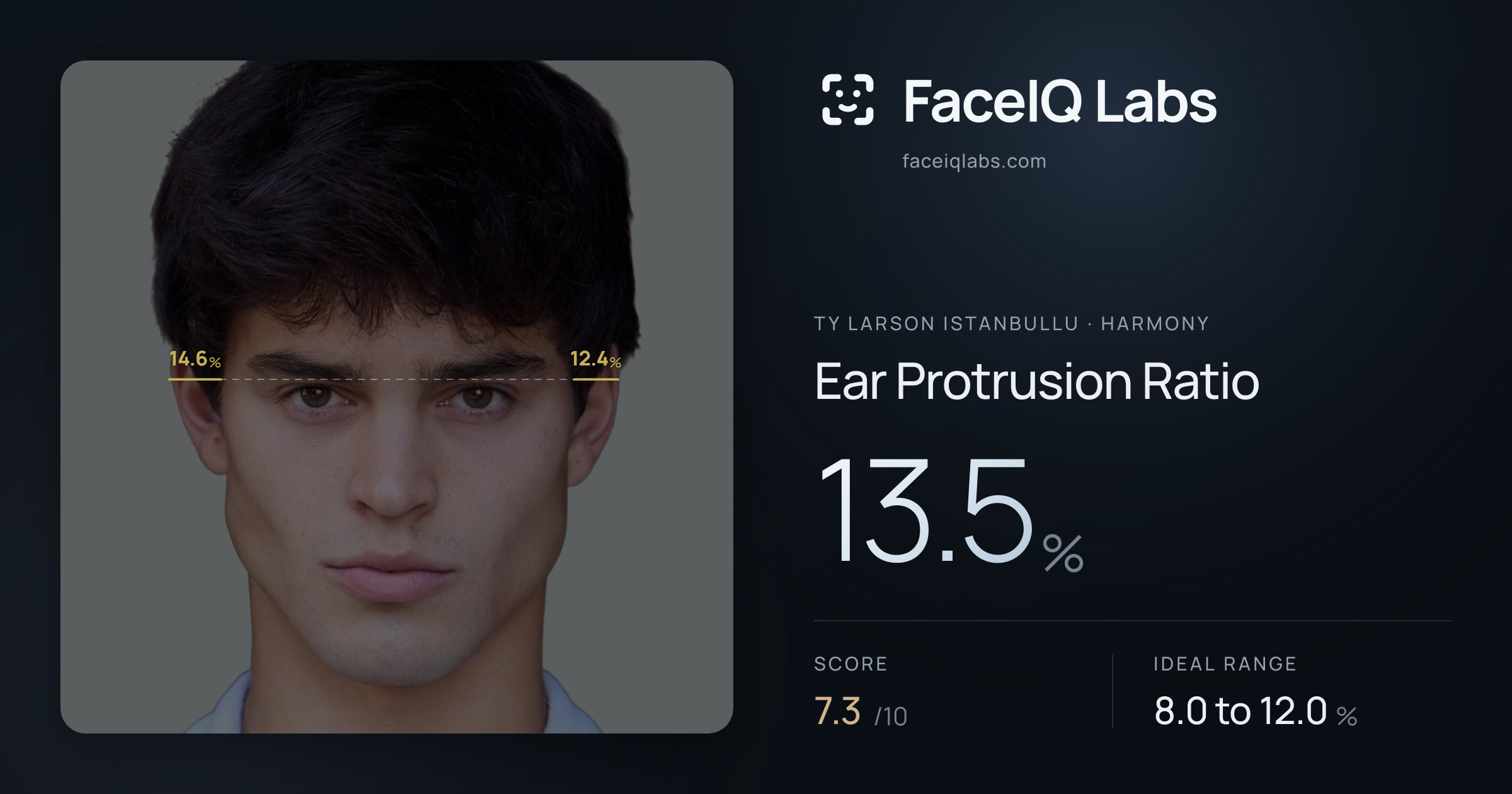 Ty Larson Istanbullu Ear Protrusion Ratio: 13.5%, drawn on the photo
