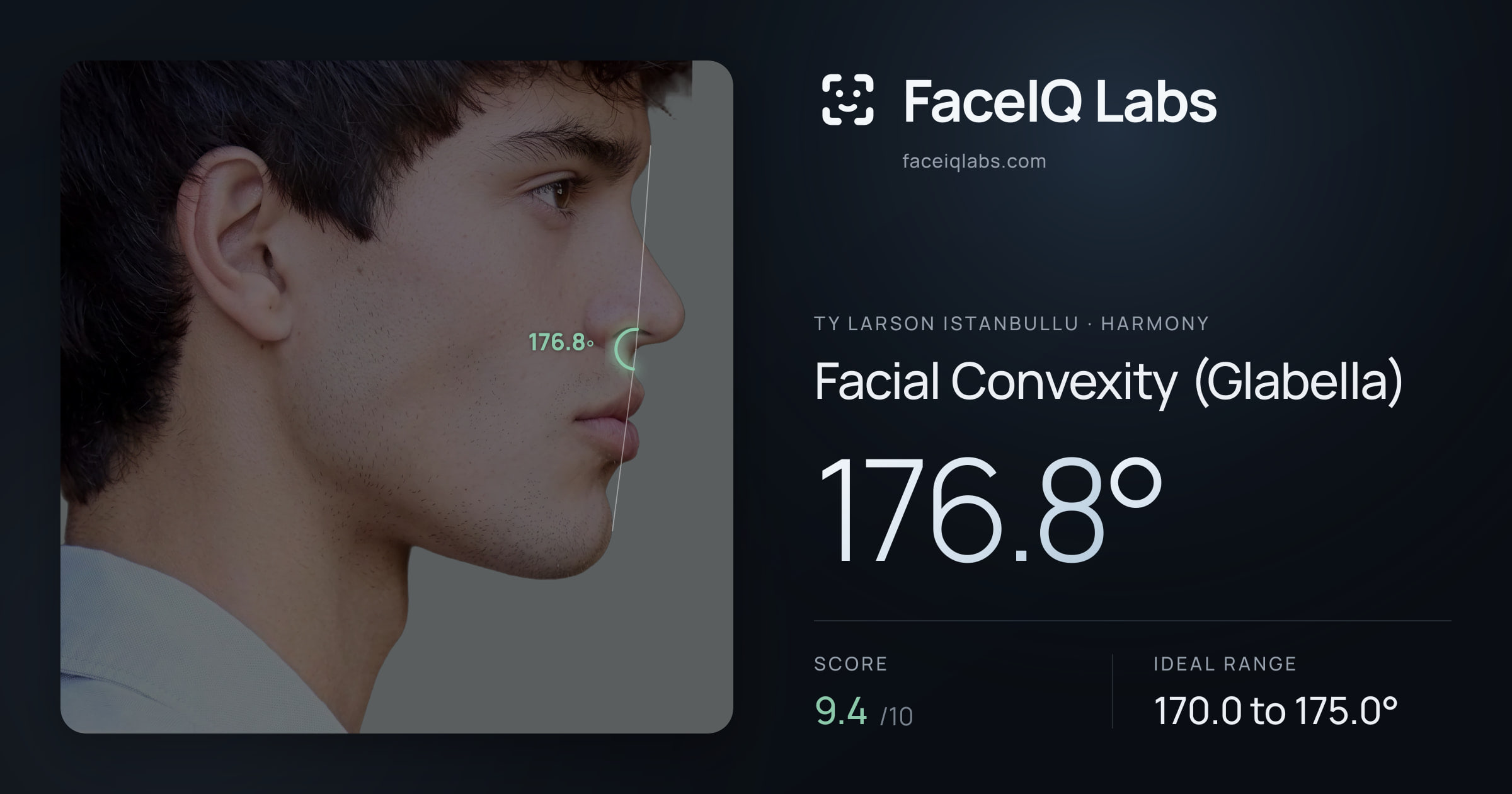 Ty Larson Istanbullu Facial Convexity (Glabella): 176.8°, drawn on the photo
