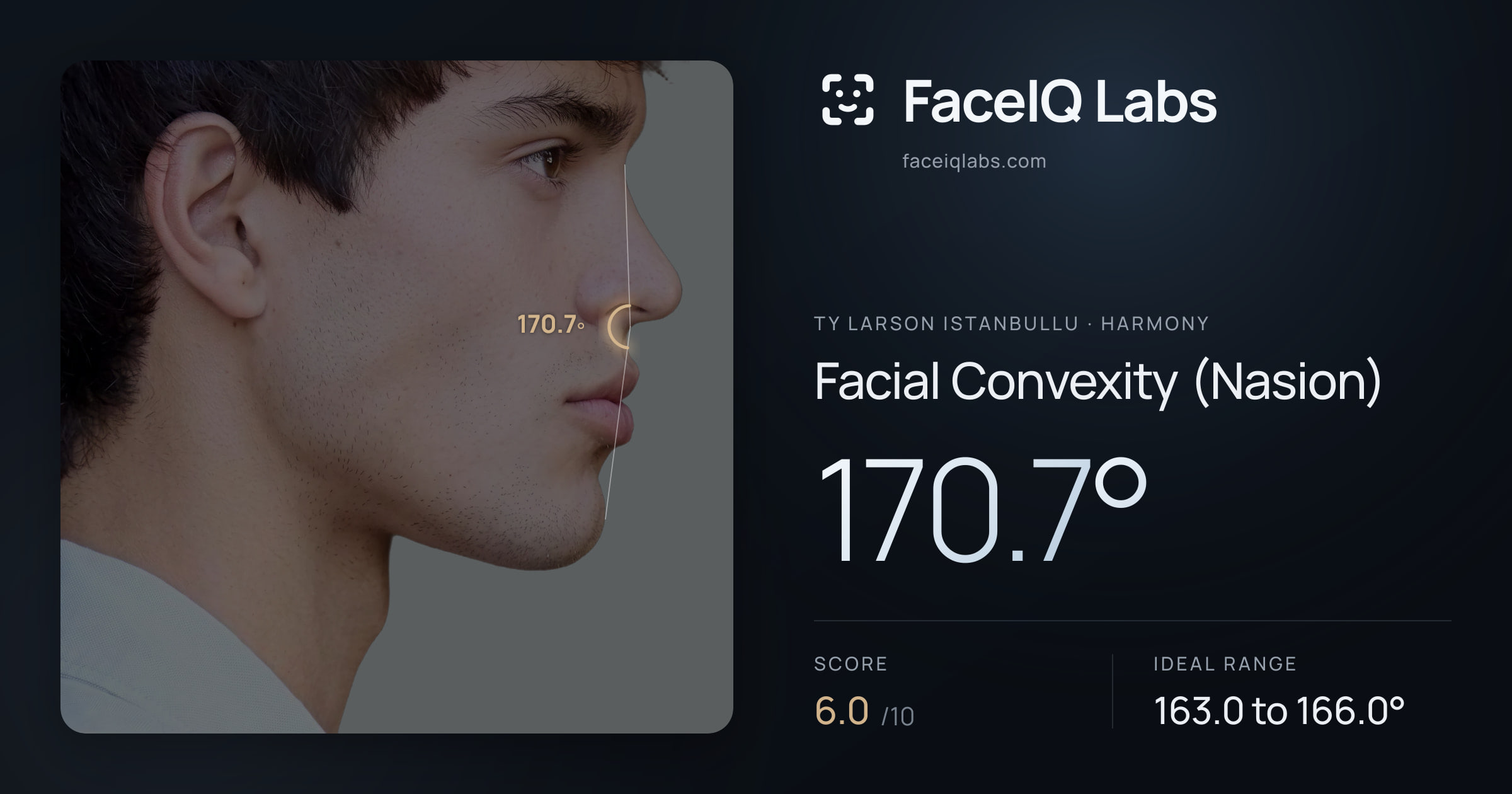 Ty Larson Istanbullu Facial Convexity (Nasion): 168.8°, drawn on the photo