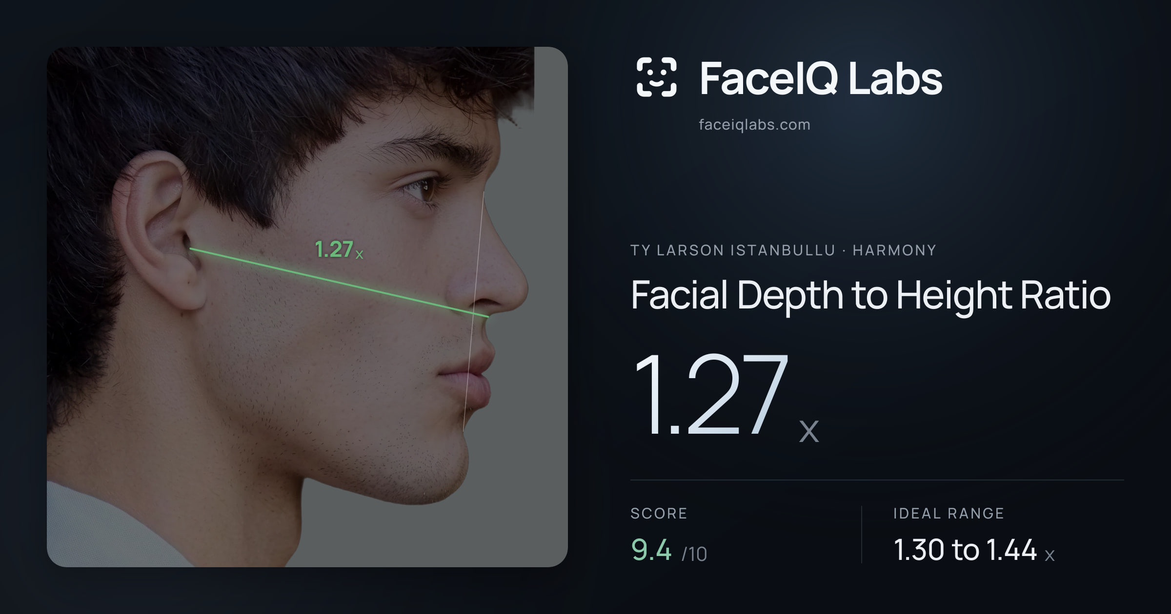 Ty Larson Istanbullu Facial Depth to Height Ratio: 1.27x, drawn on the photo