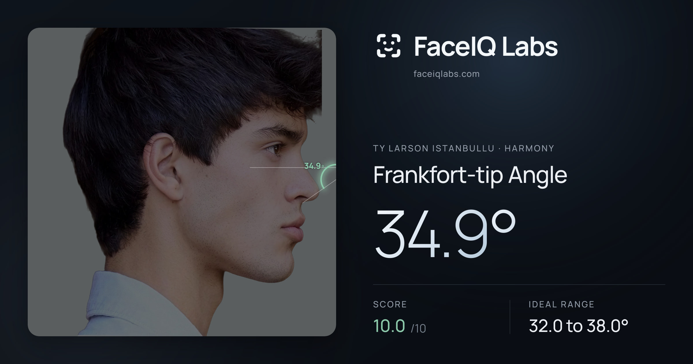 Ty Larson Istanbullu Frankfort-tip Angle: 34.9°, drawn on the photo