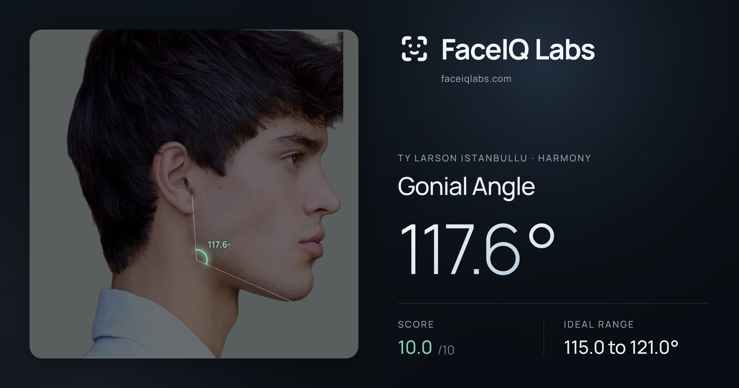 Ty Larson Istanbullu Gonial Angle: 117.6°, drawn on the photo