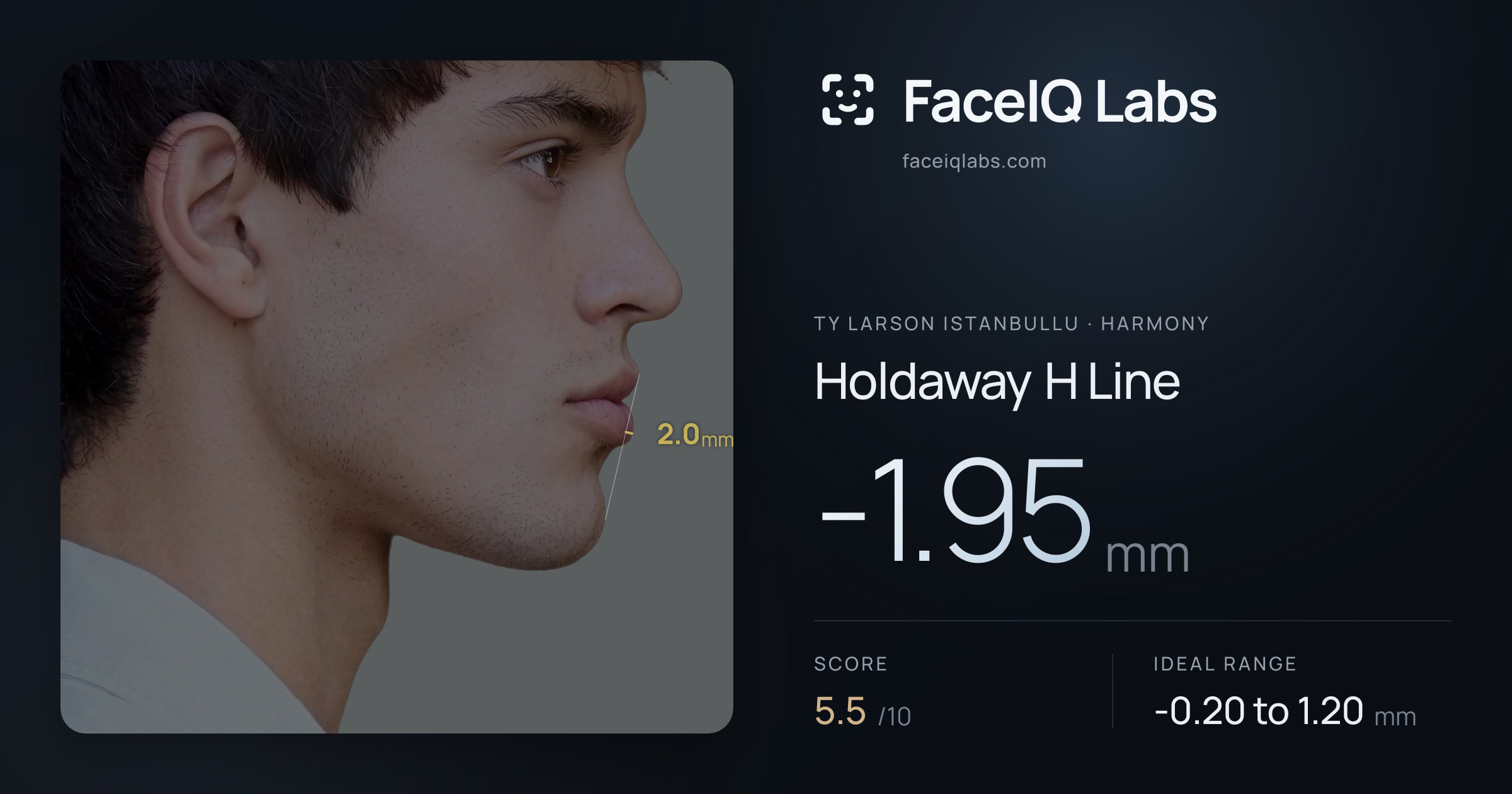 Ty Larson Istanbullu Holdaway H Line: -1.95mm, drawn on the photo