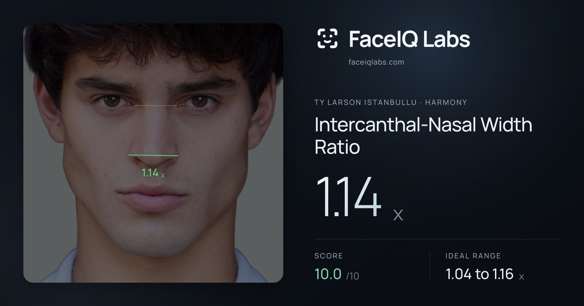 Ty Larson Istanbullu Intercanthal-Nasal Width Ratio: 1.14x, drawn on the photo