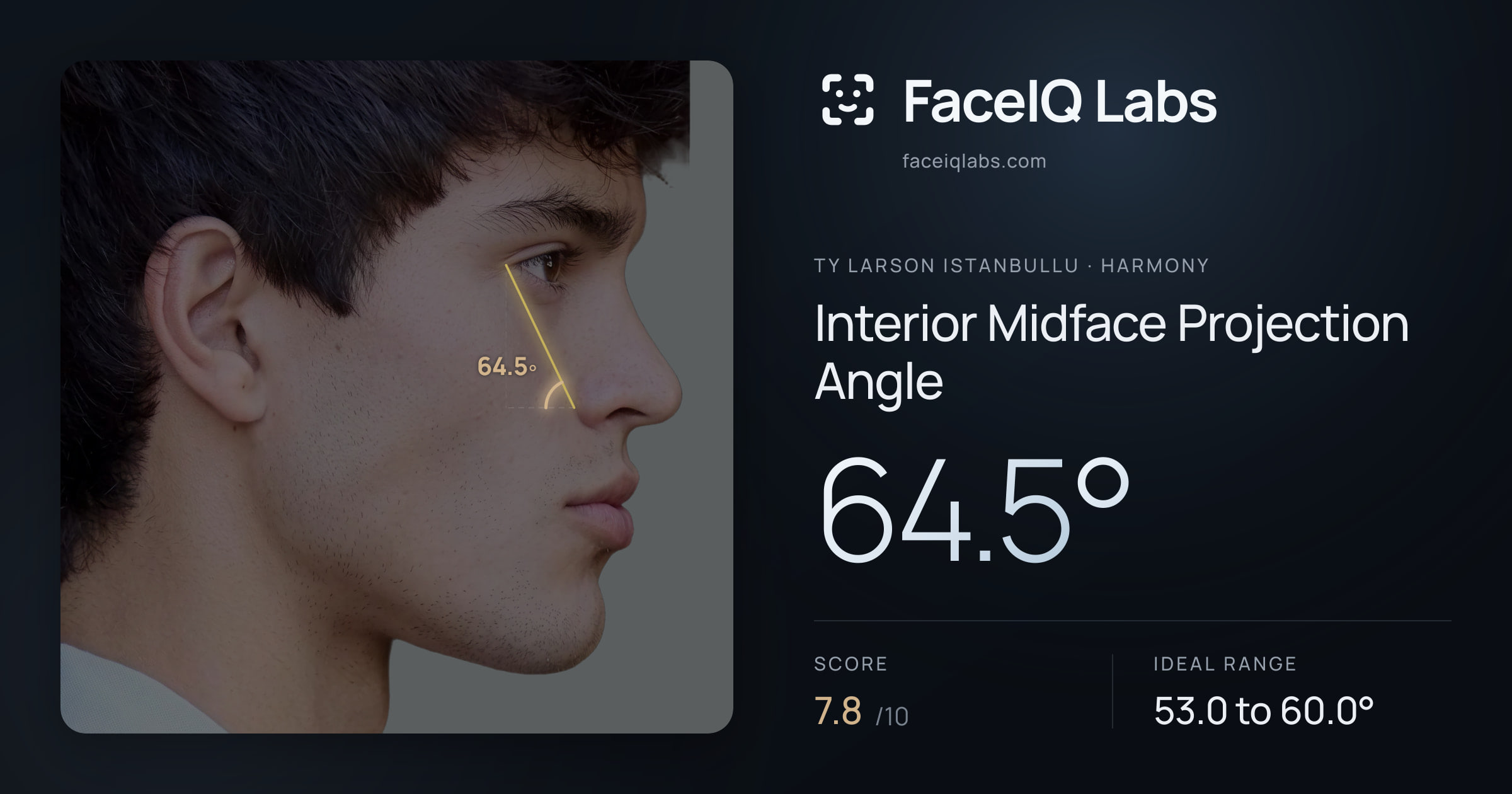 Ty Larson Istanbullu Interior Midface Projection Angle: 64.5°, drawn on the photo