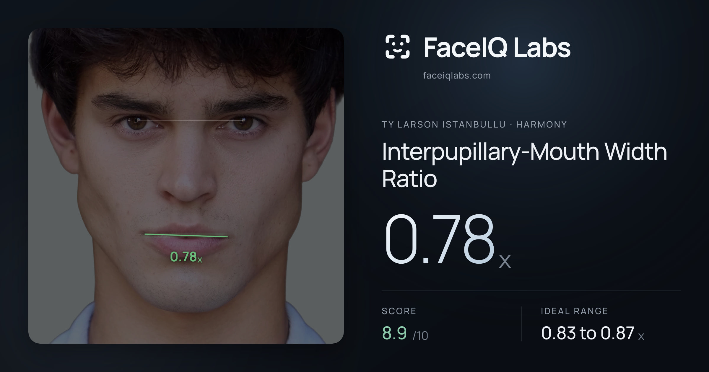 Ty Larson Istanbullu Interpupillary-Mouth Width Ratio: 0.78x, drawn on the photo