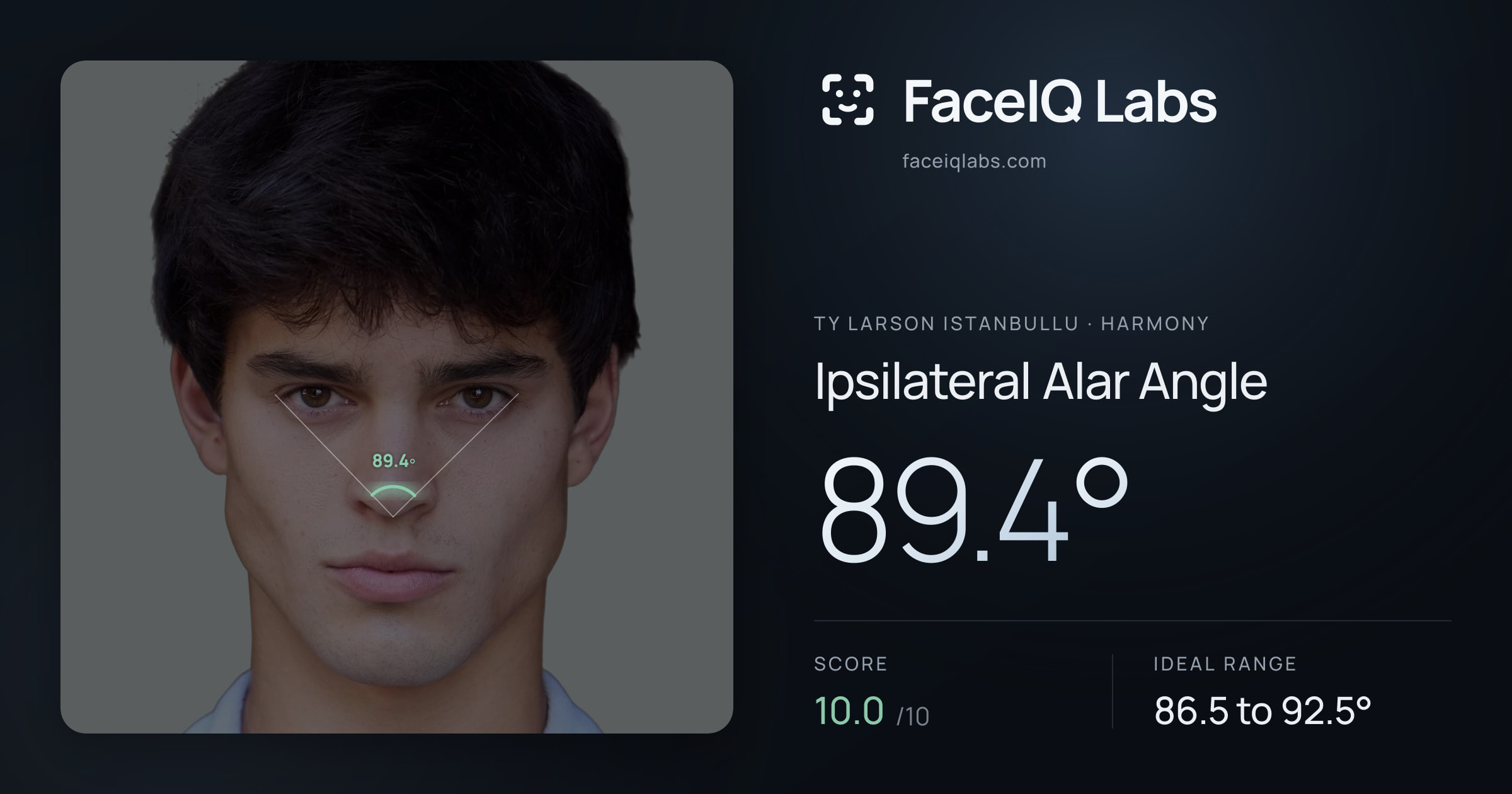 Ty Larson Istanbullu Ipsilateral Alar Angle: 89.4°, drawn on the photo