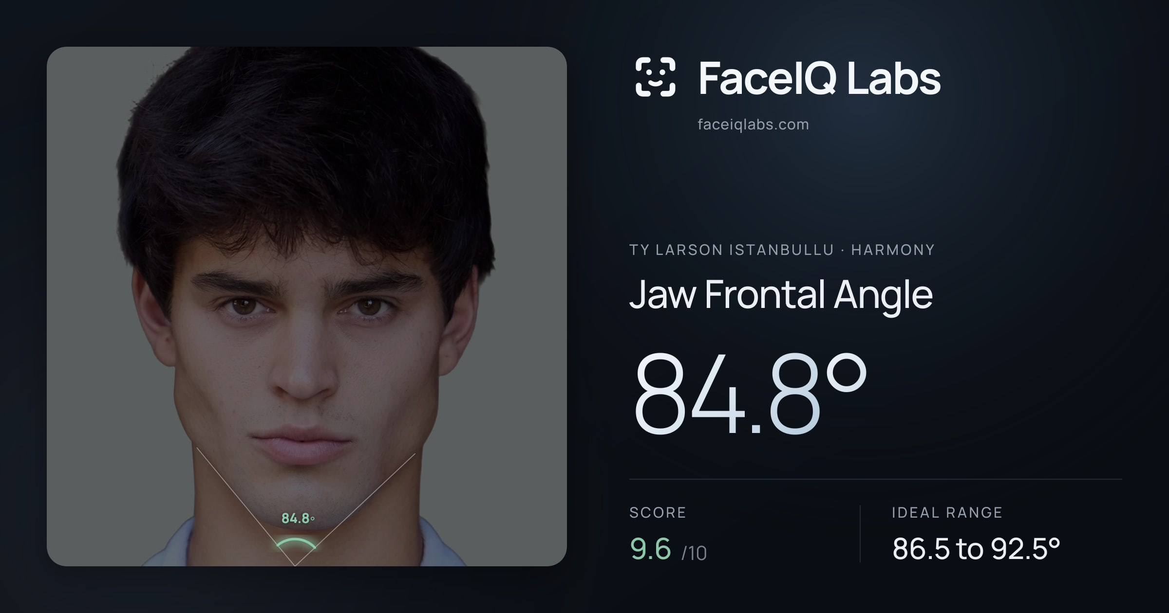 Ty Larson Istanbullu Jaw Frontal Angle: 84.2°, drawn on the photo