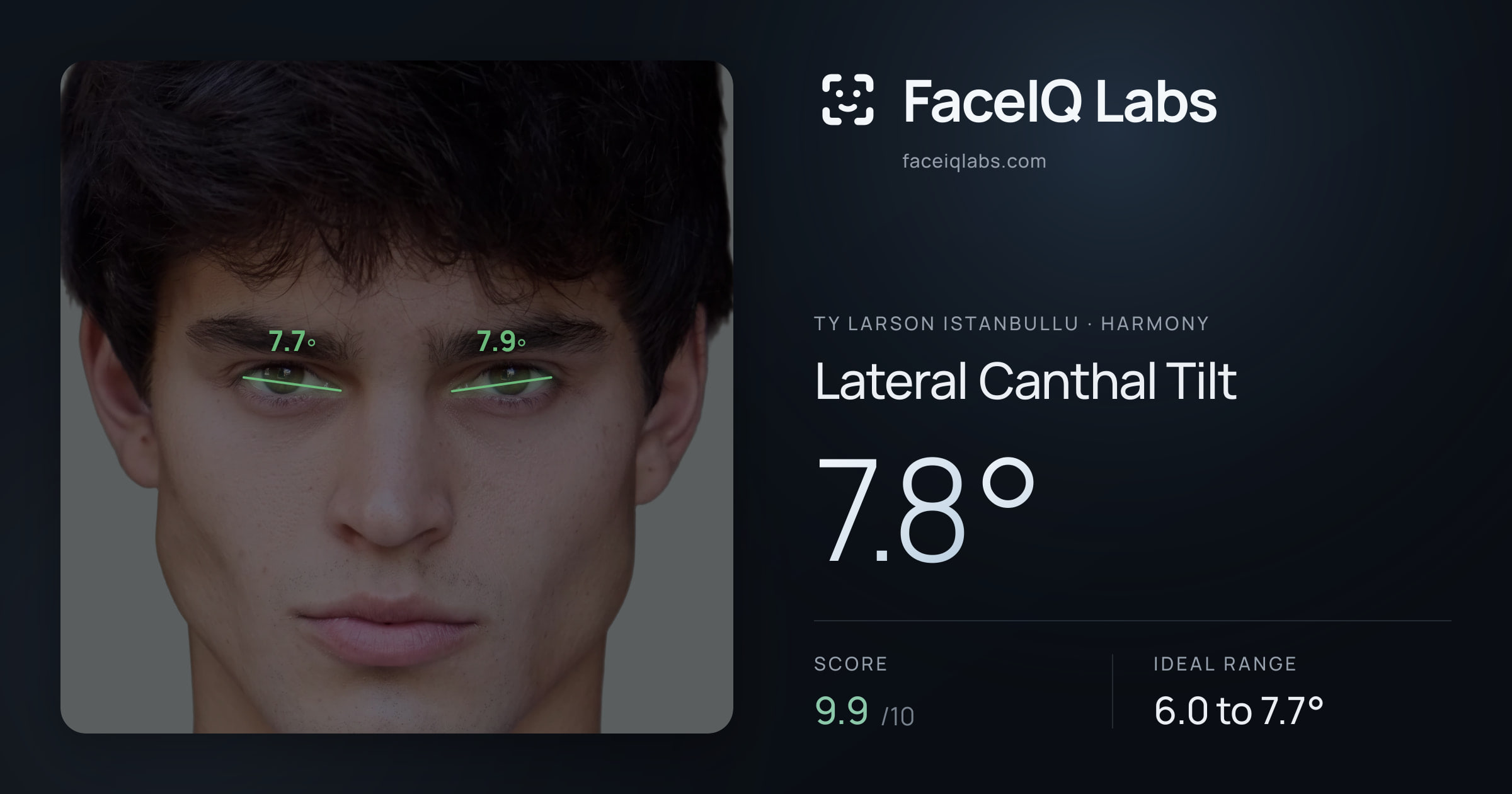 Ty Larson Istanbullu Lateral Canthal Tilt: 7.8°, drawn on the photo