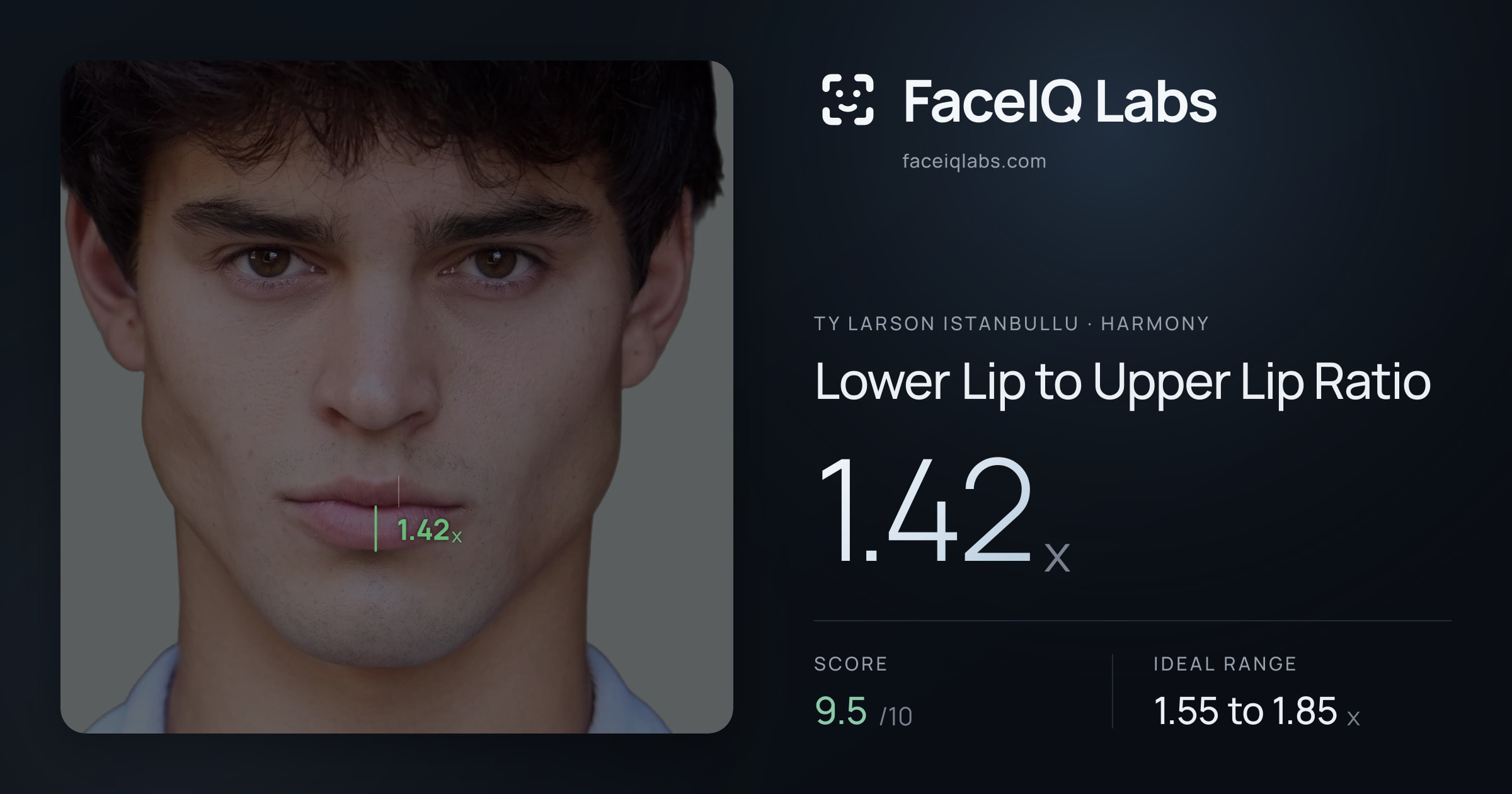Ty Larson Istanbullu Lower Lip to Upper Lip Ratio: 1.42x, drawn on the photo