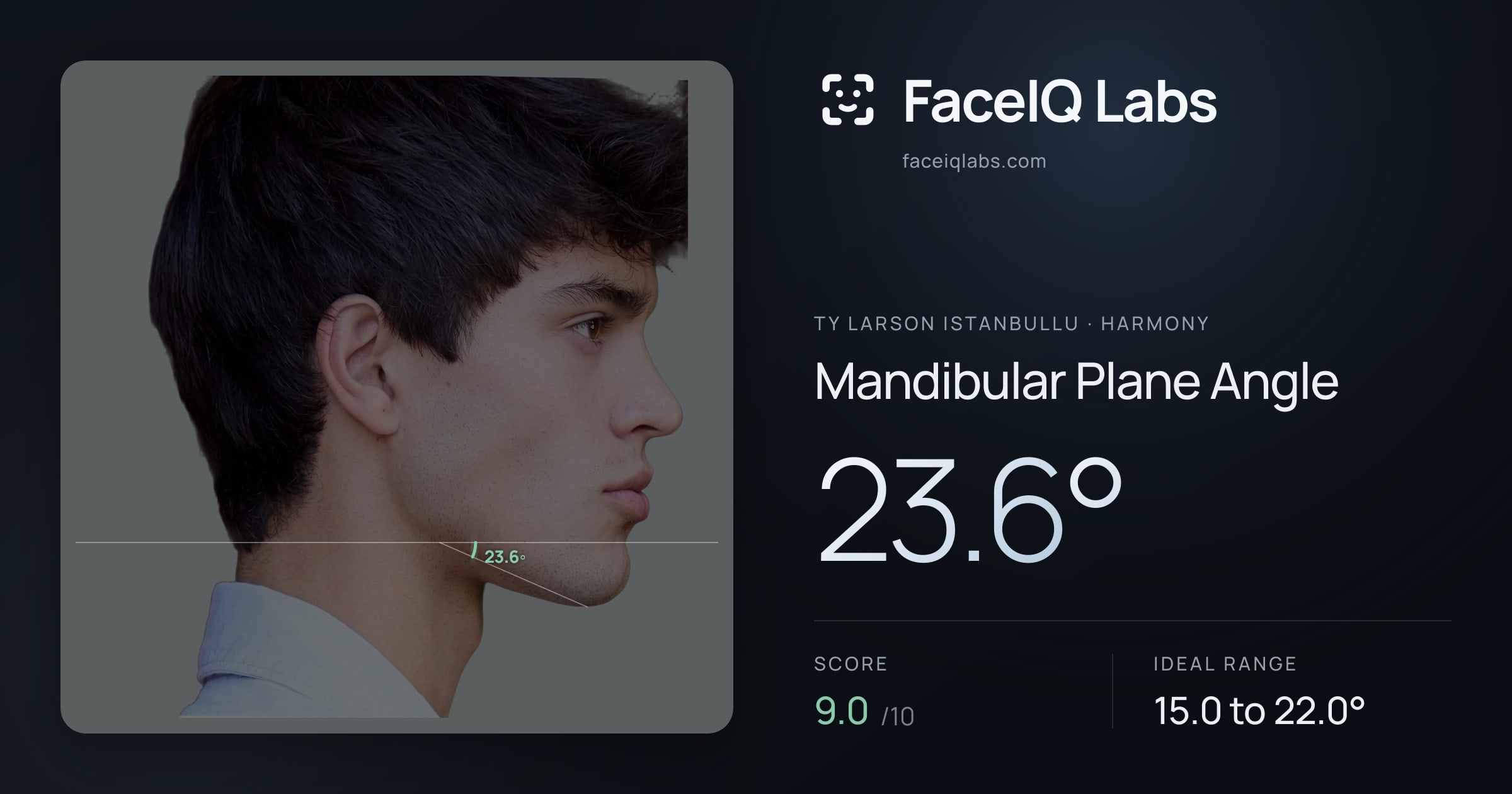 Ty Larson Istanbullu Mandibular Plane Angle: 23.6°, drawn on the photo