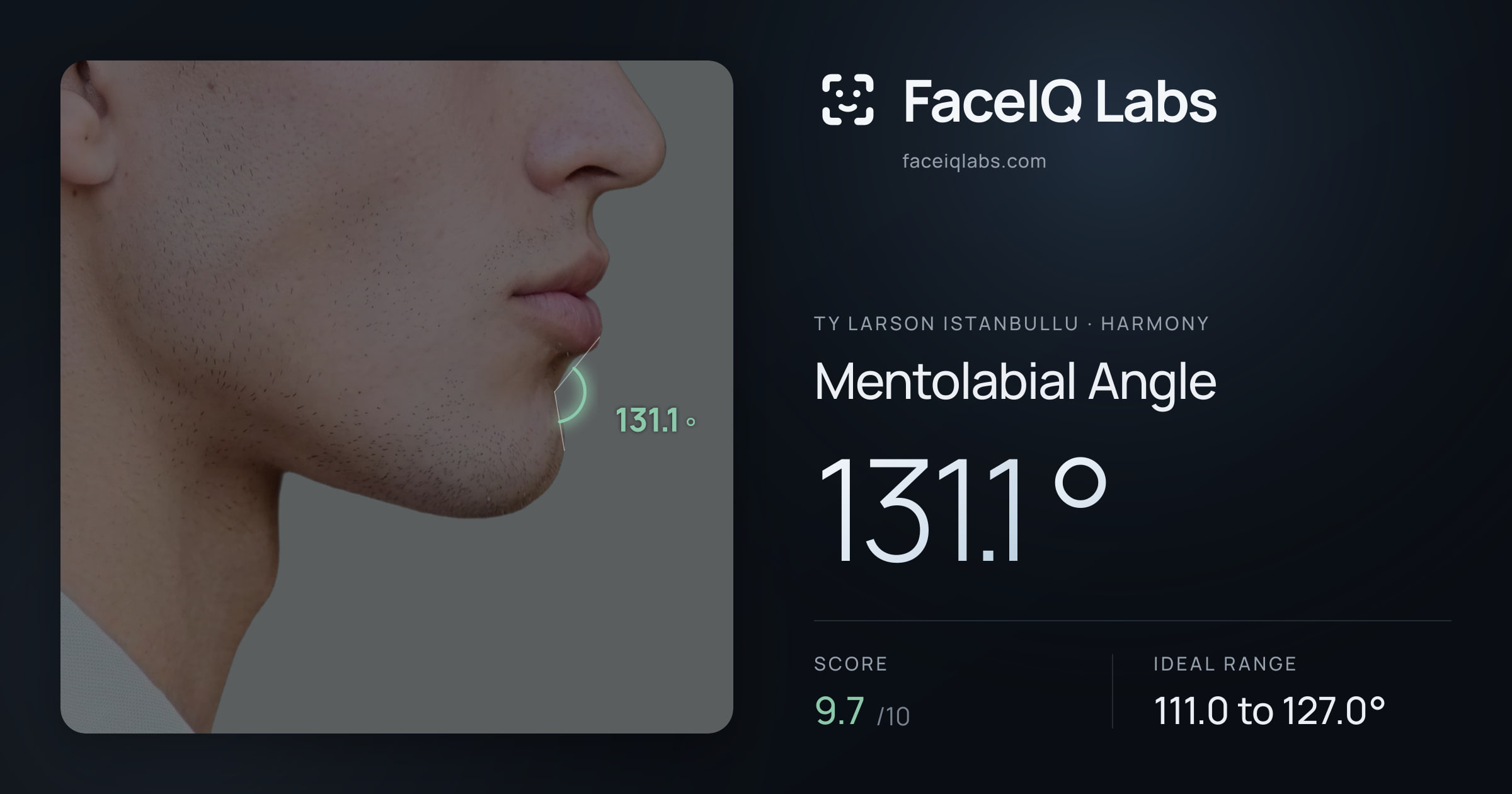 Ty Larson Istanbullu Mentolabial Angle: 131.1°, drawn on the photo