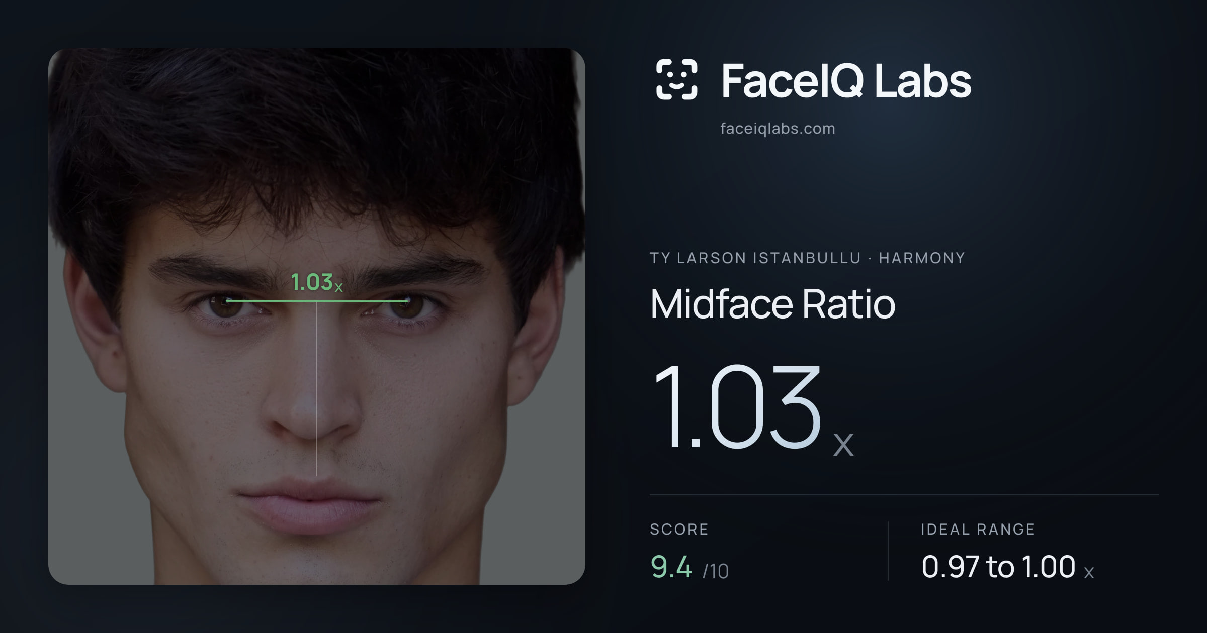 Ty Larson Istanbullu Midface Ratio: 1.03x, drawn on the photo