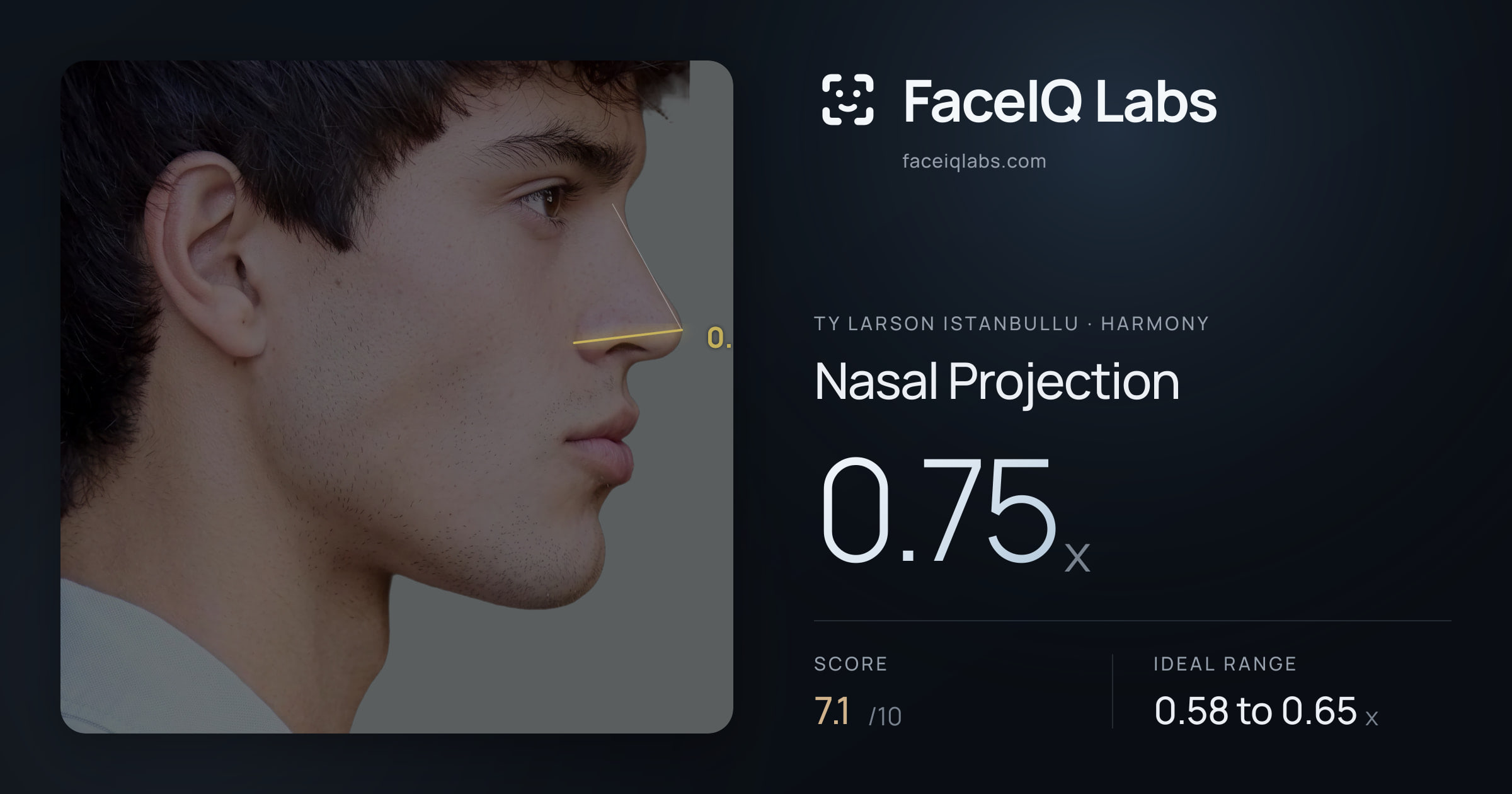 Ty Larson Istanbullu Nasal Projection: 0.75x, drawn on the photo