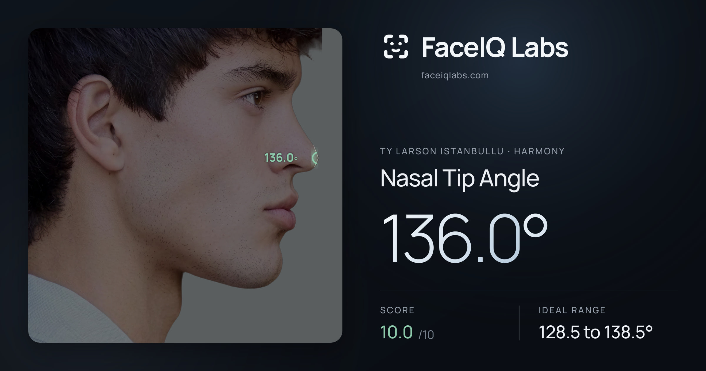 Ty Larson Istanbullu Nasal Tip Angle: 136.0°, drawn on the photo