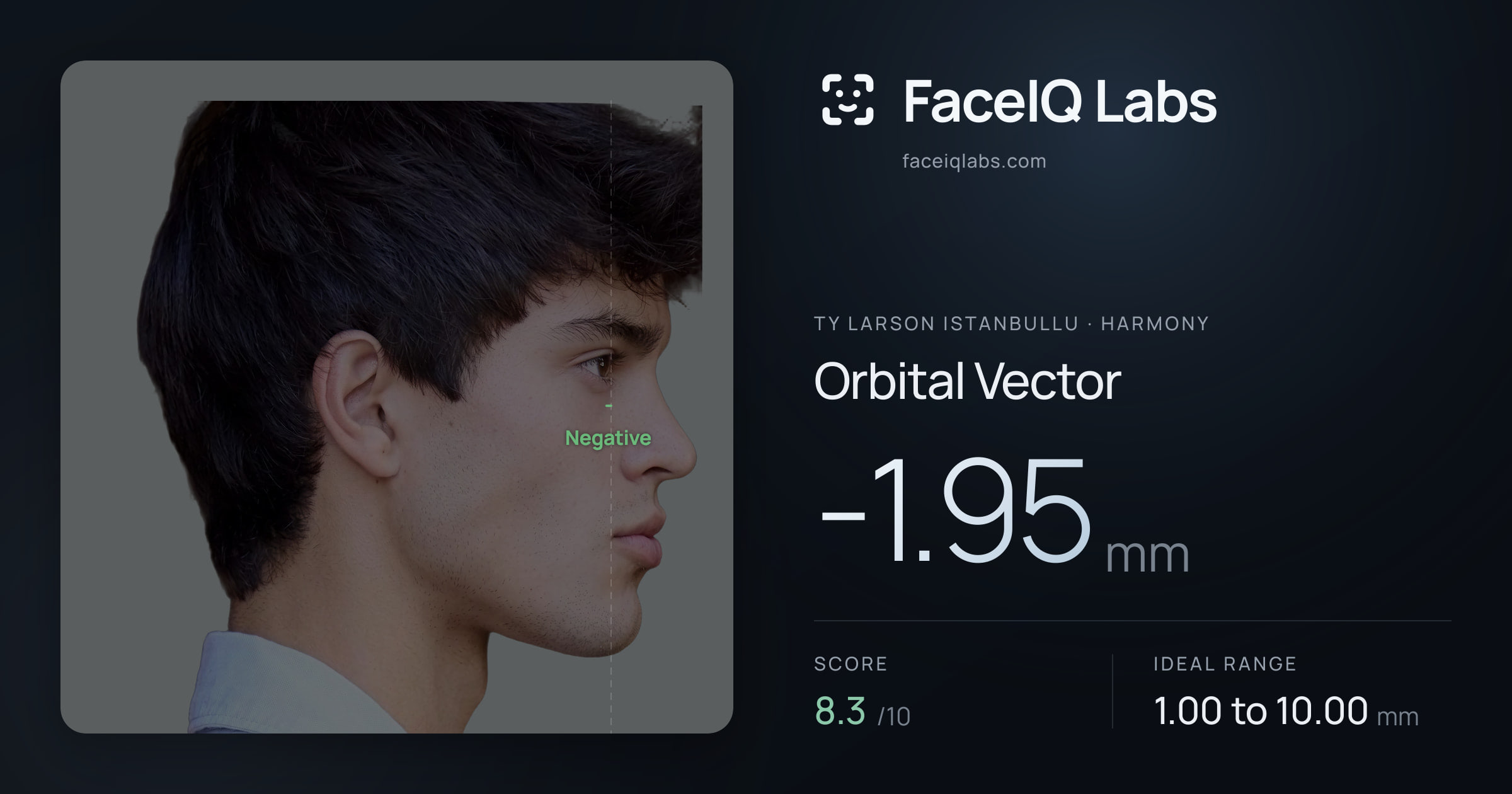 Ty Larson Istanbullu Orbital Vector: -1.95mm, drawn on the photo