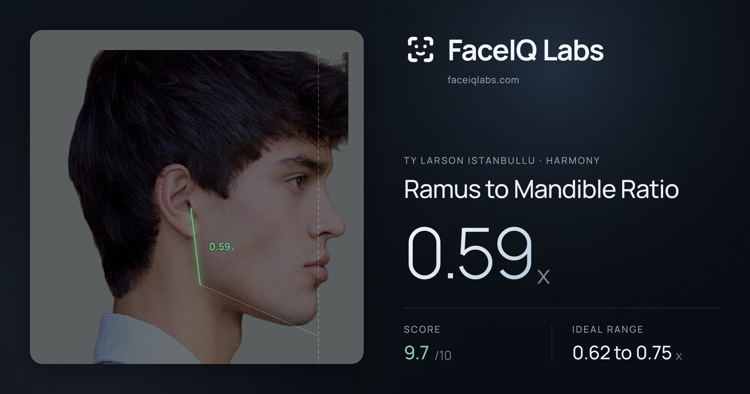 Ty Larson Istanbullu Ramus to Mandible Ratio: 0.59x, drawn on the photo