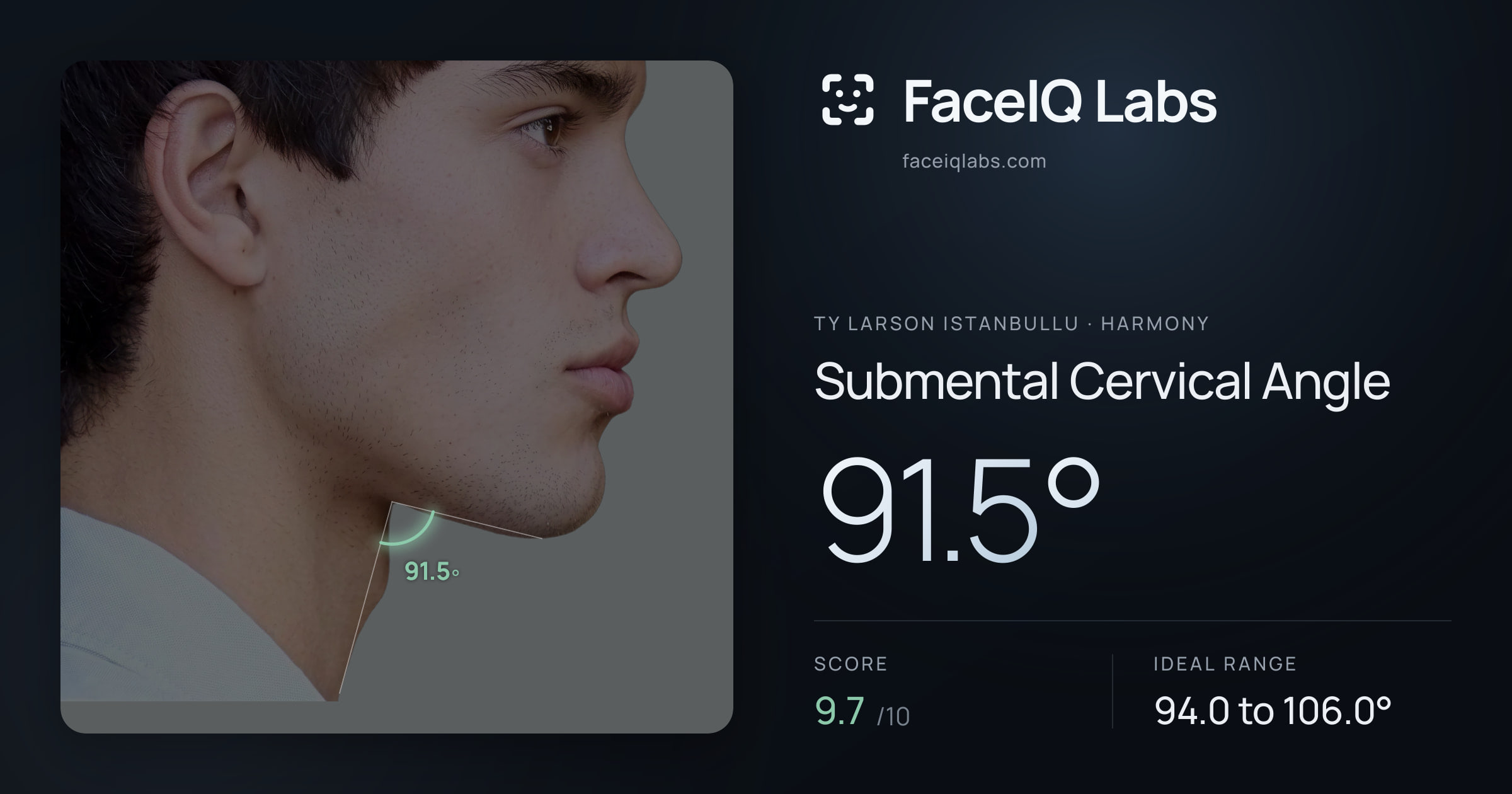 Ty Larson Istanbullu Submental Cervical Angle: 91.5°, drawn on the photo