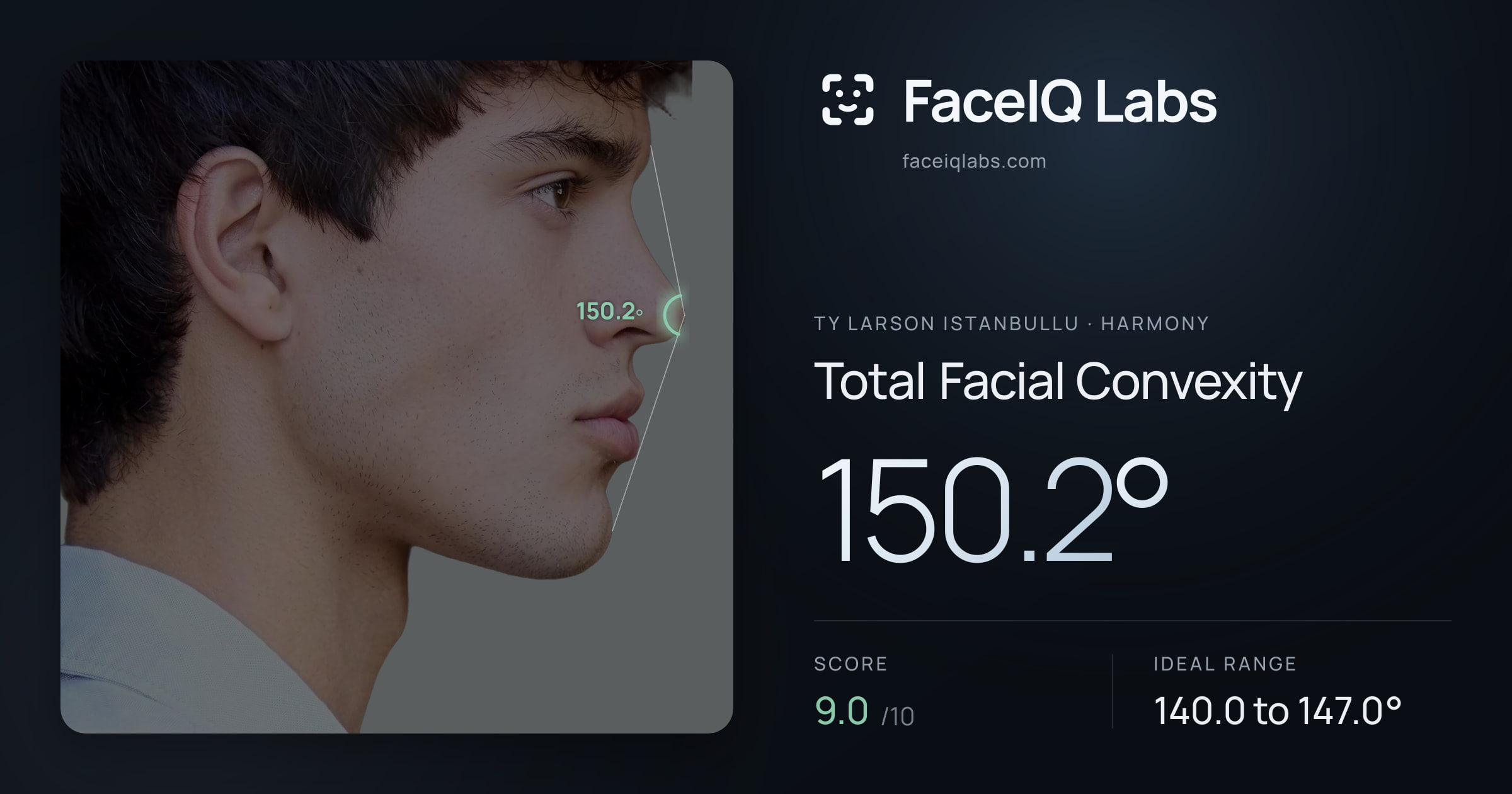 Ty Larson Istanbullu Total Facial Convexity: 150.2°, drawn on the photo