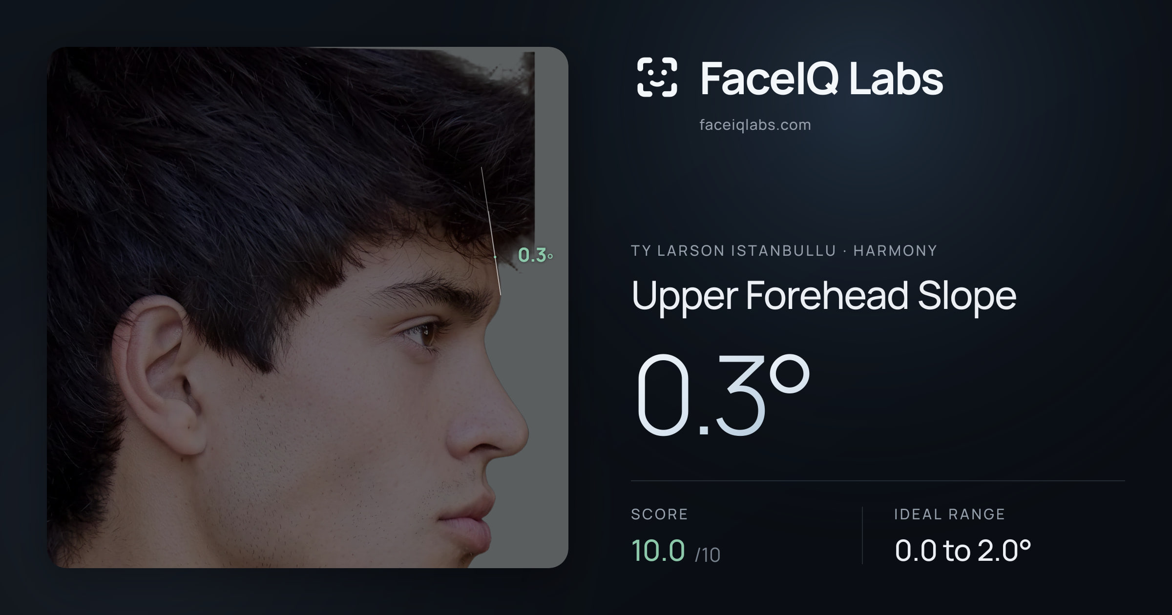 Ty Larson Istanbullu Upper Forehead Slope: 0.3°, drawn on the photo