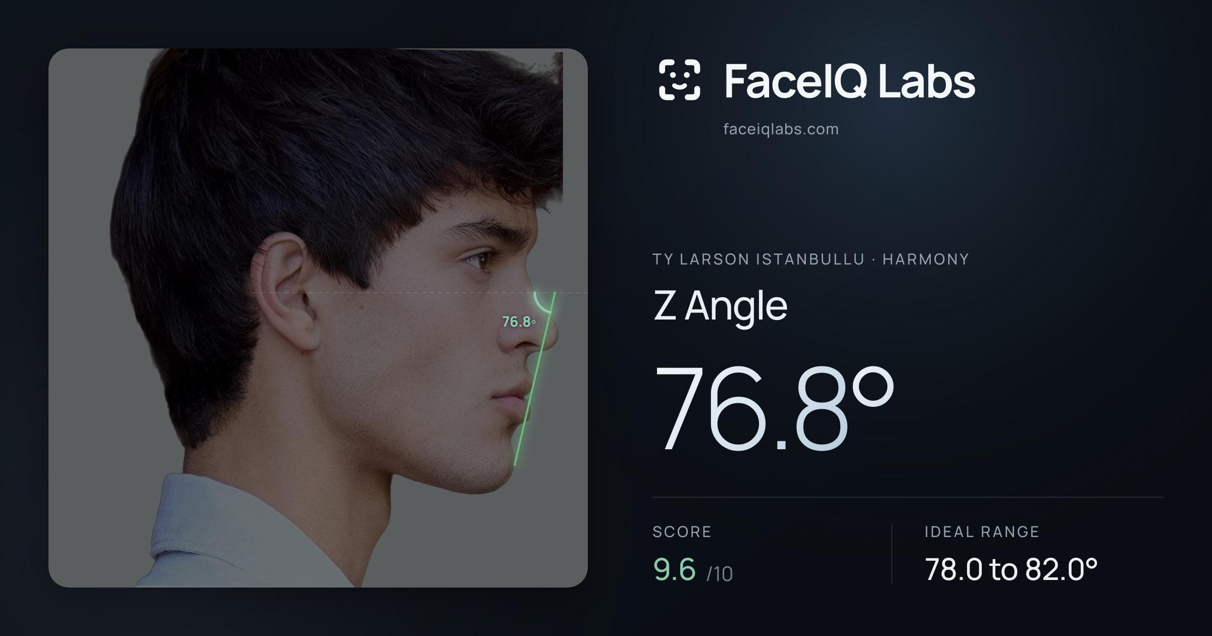 Ty Larson Istanbullu Z Angle: 76.8°, drawn on the photo