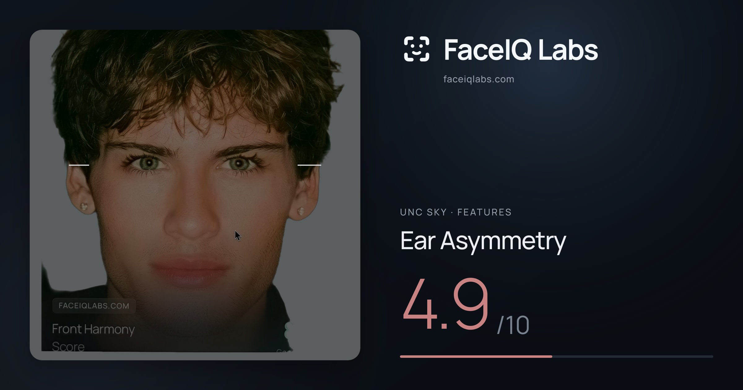 Unc Sky Ear Asymmetry: 4.9/10, drawn on the photo