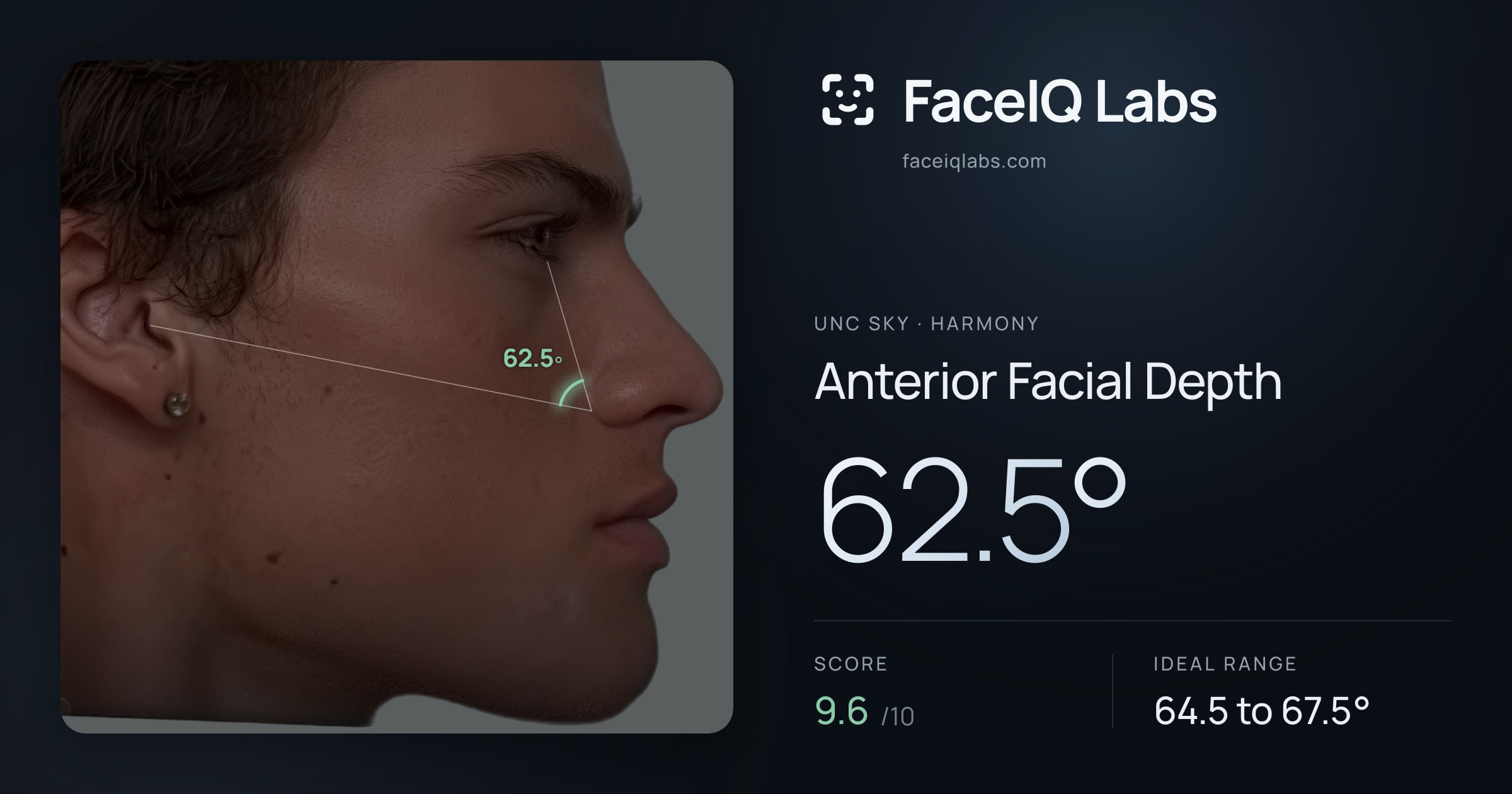Unc Sky Anterior Facial Depth: 62.5°, drawn on the photo