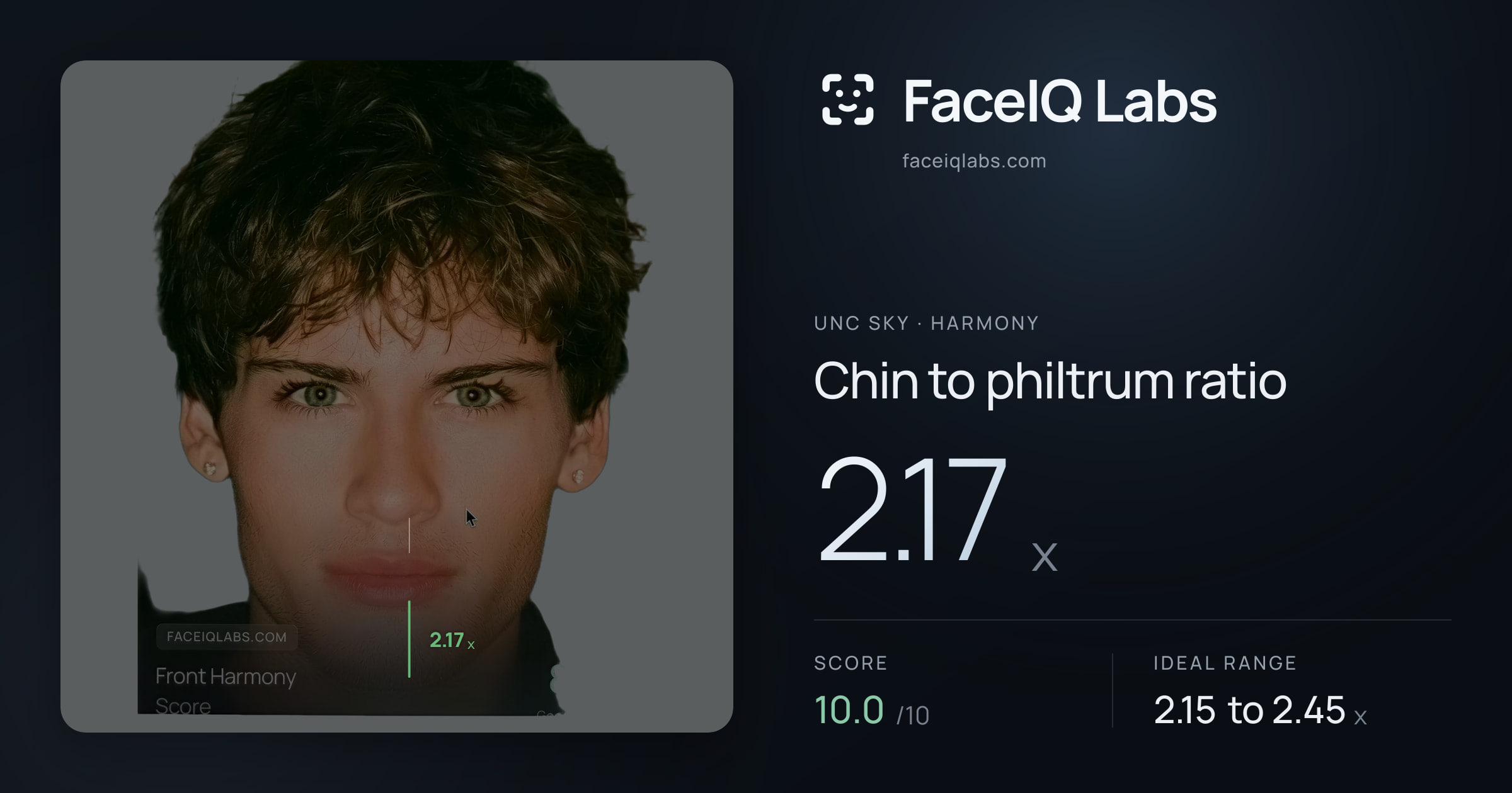 Unc Sky Chin to philtrum ratio: 2.17x, drawn on the photo