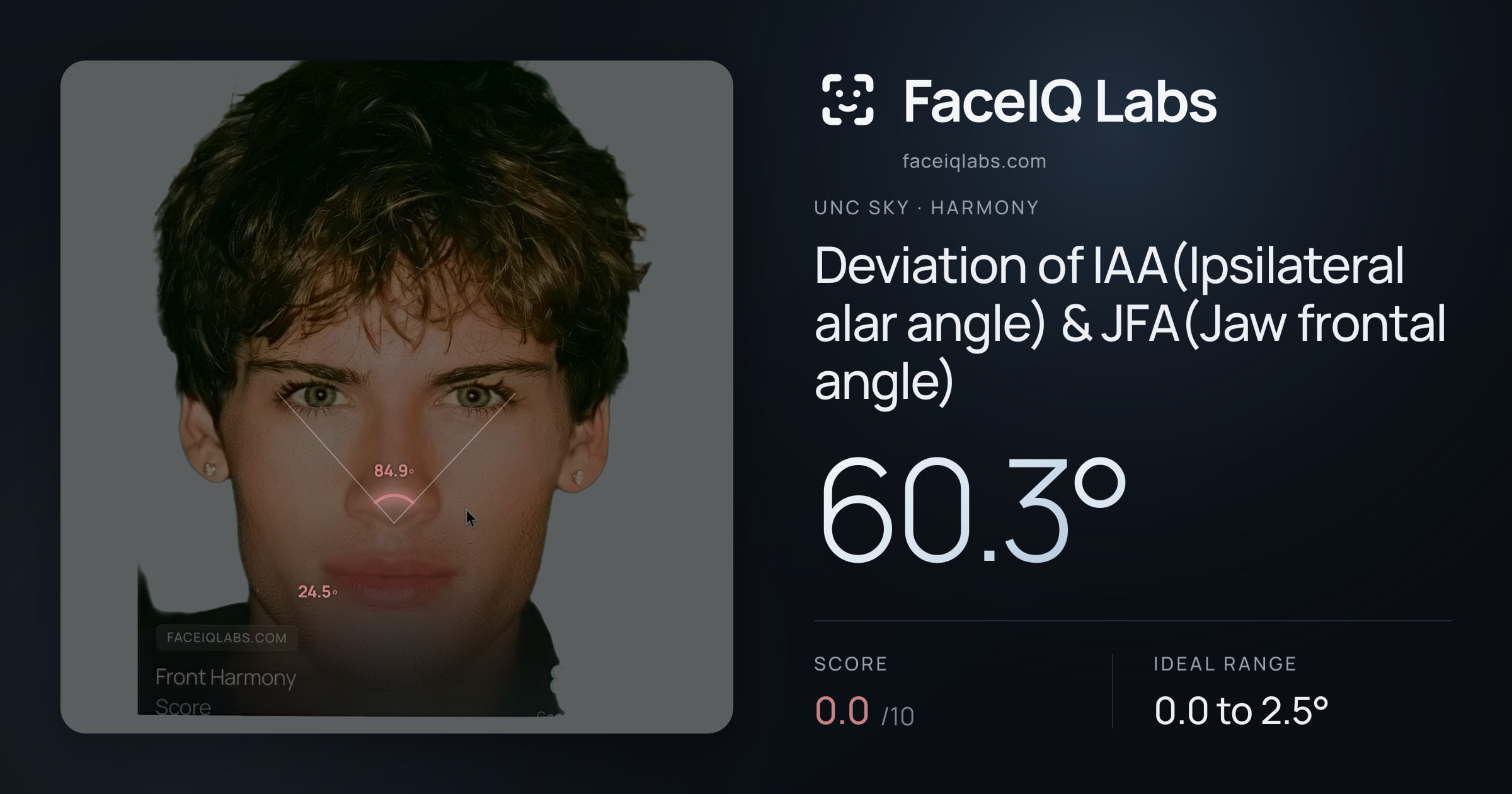 Unc Sky Deviation of IAA(Ipsilateral alar angle) & JFA(Jaw frontal angle): 60.3°, drawn on the photo