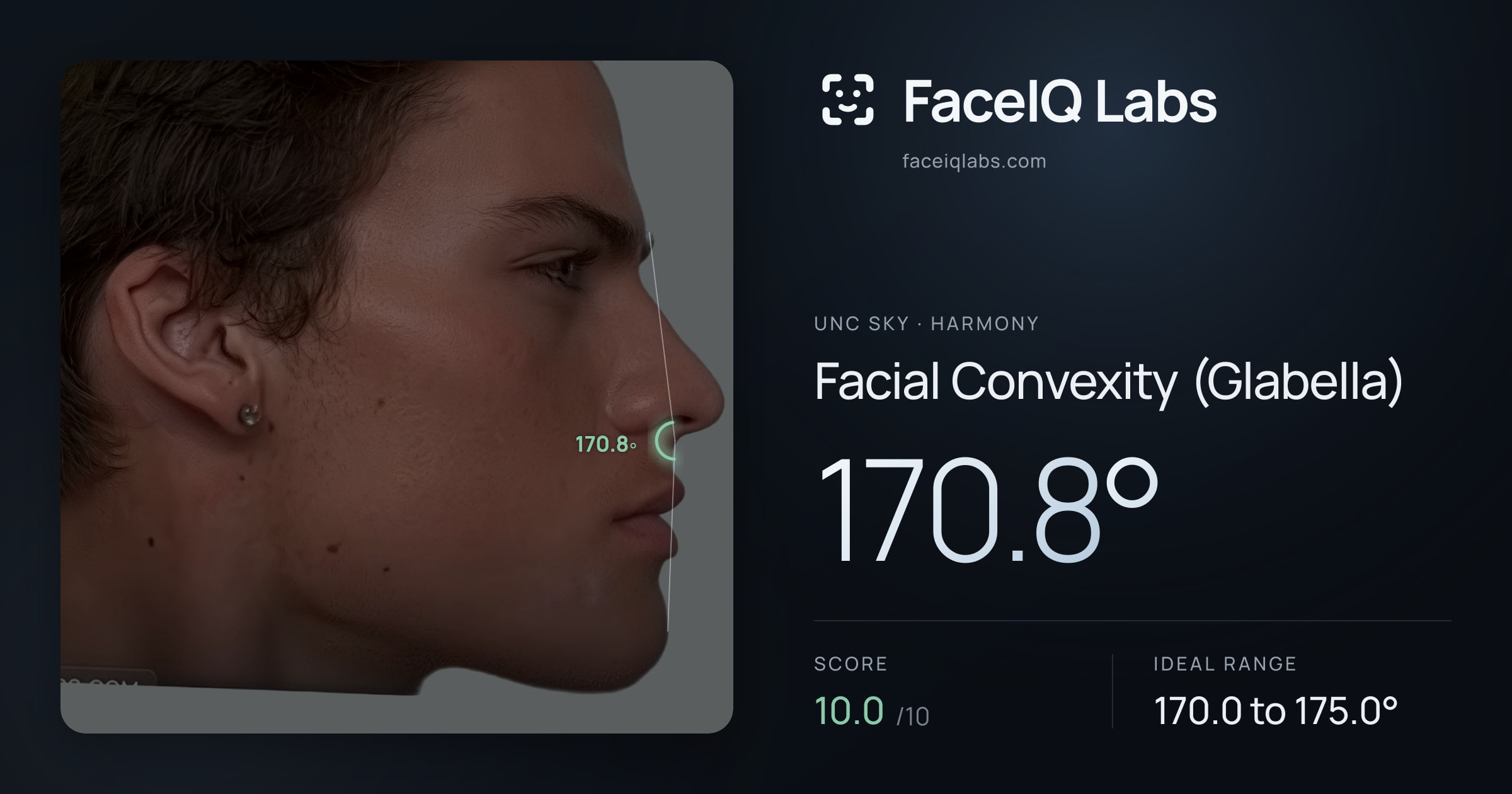 Unc Sky Facial Convexity (Glabella): 170.8°, drawn on the photo