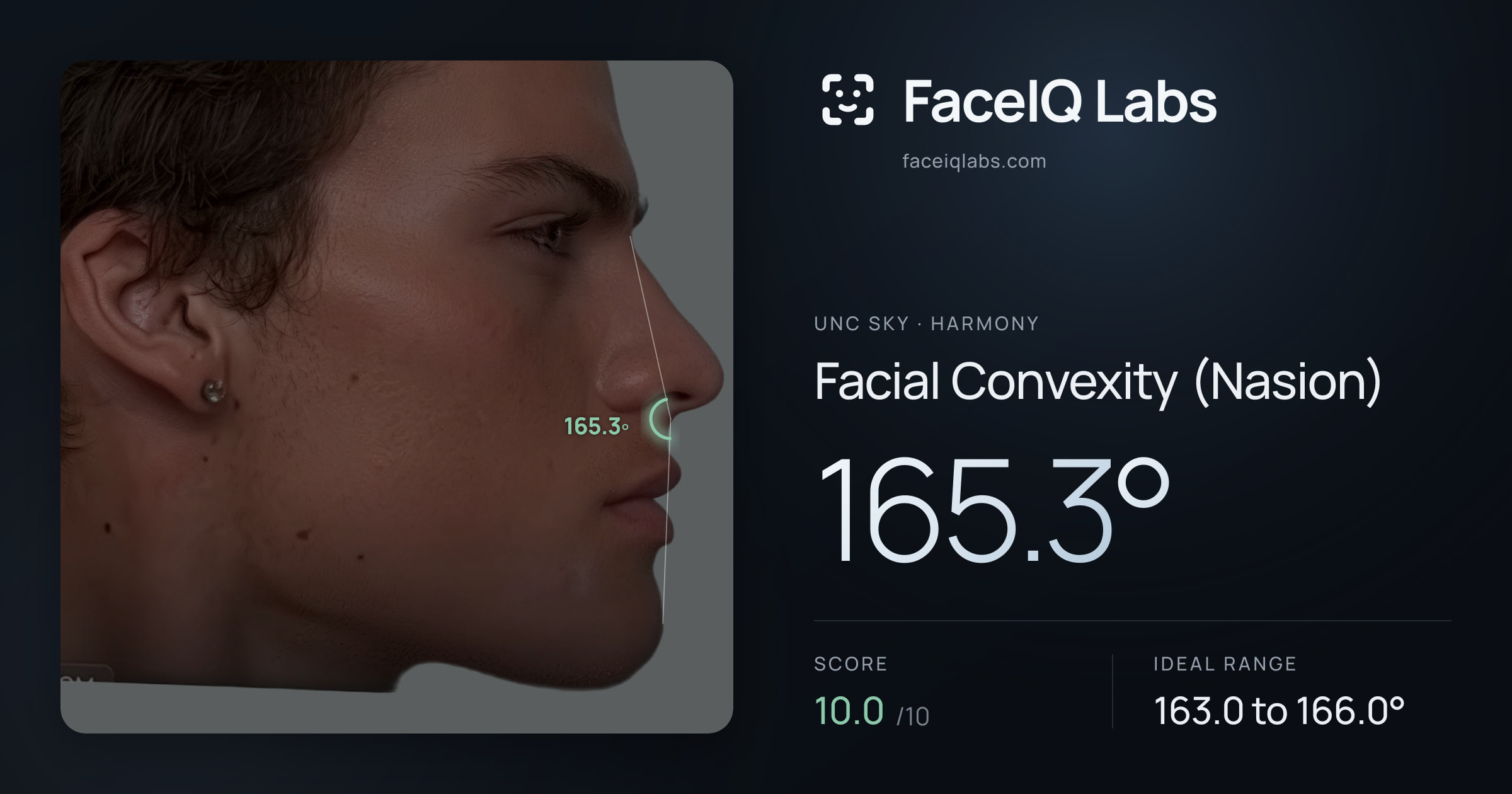 Unc Sky Facial Convexity (Nasion): 165.3°, drawn on the photo