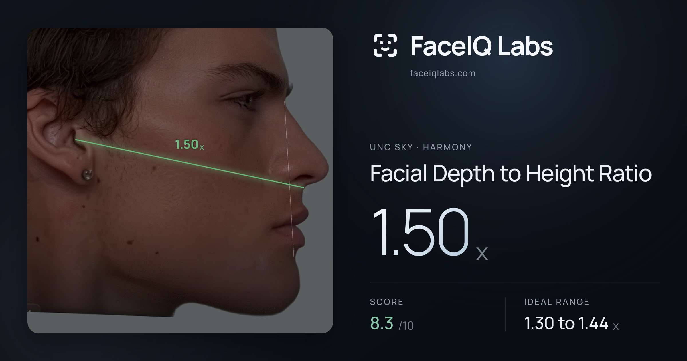 Unc Sky Facial Depth to Height Ratio: 1.50x, drawn on the photo