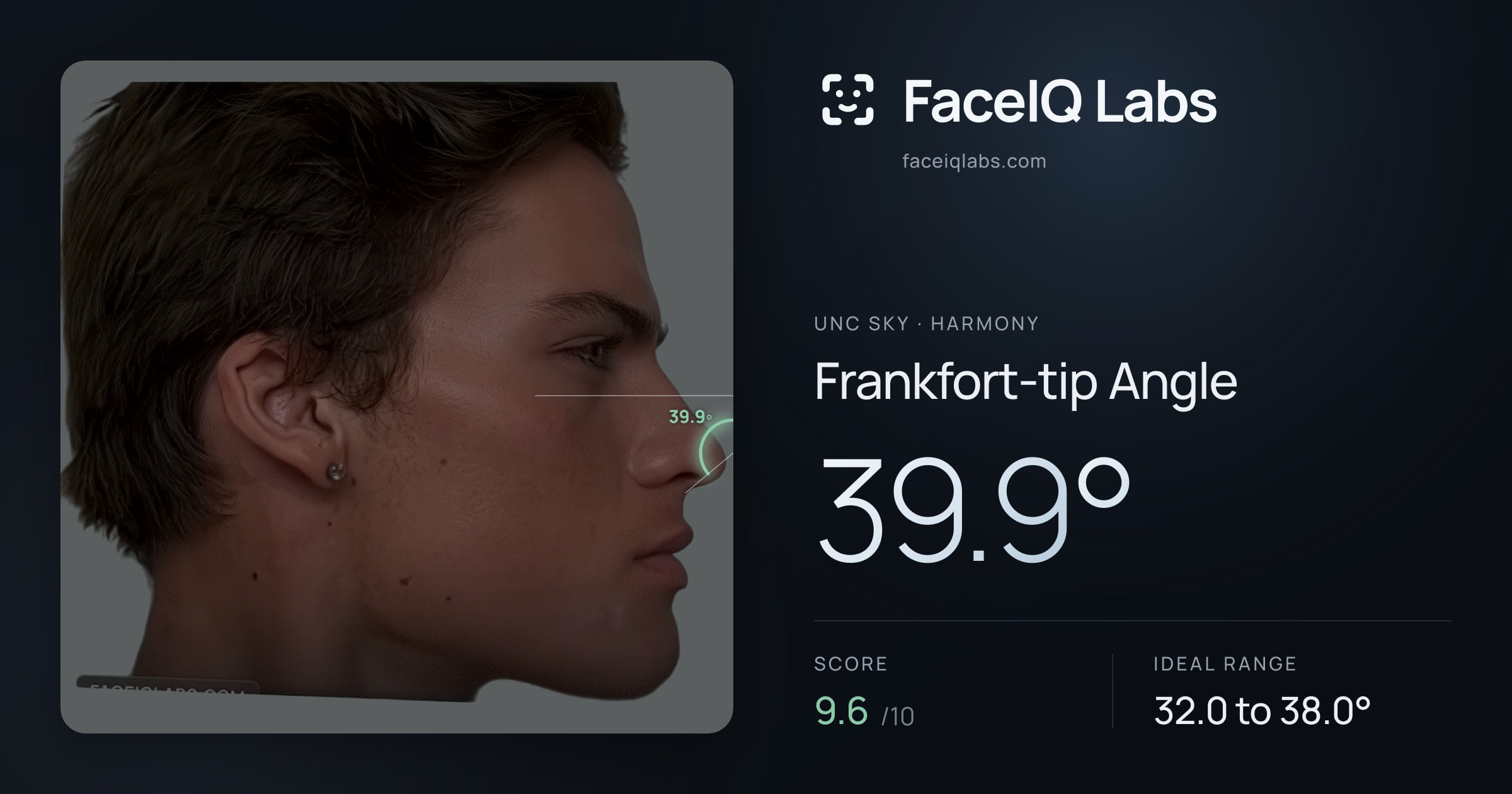Unc Sky Frankfort-tip Angle: 39.9°, drawn on the photo