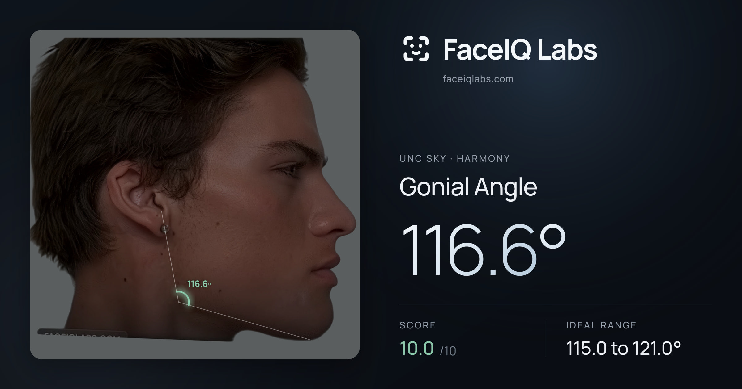 Unc Sky Gonial Angle: 116.6°, drawn on the photo