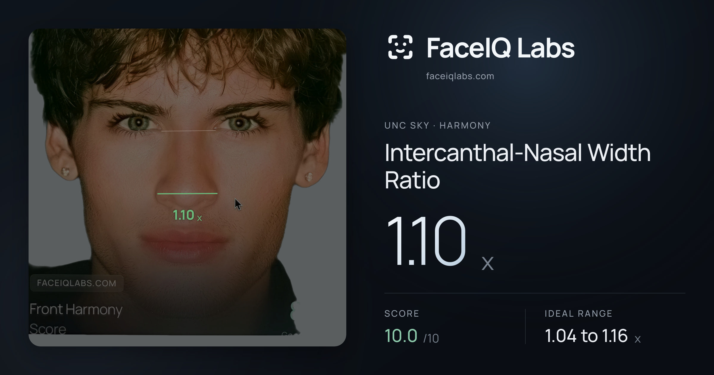 Unc Sky Intercanthal-Nasal Width Ratio: 1.10x, drawn on the photo