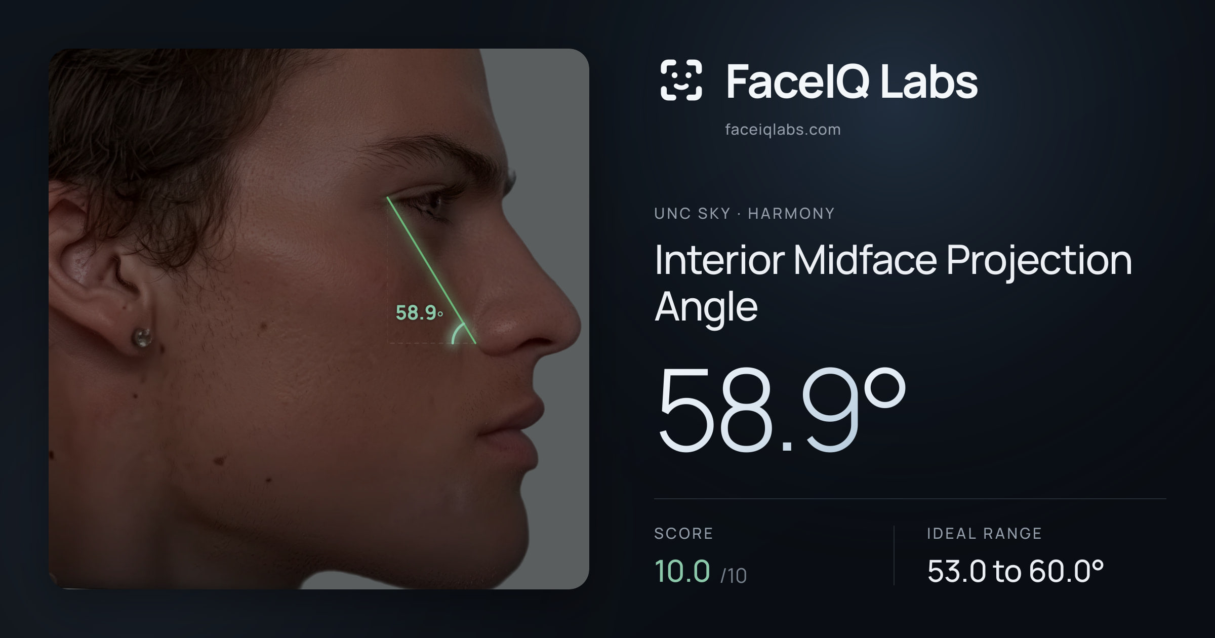 Unc Sky Interior Midface Projection Angle: 58.9°, drawn on the photo