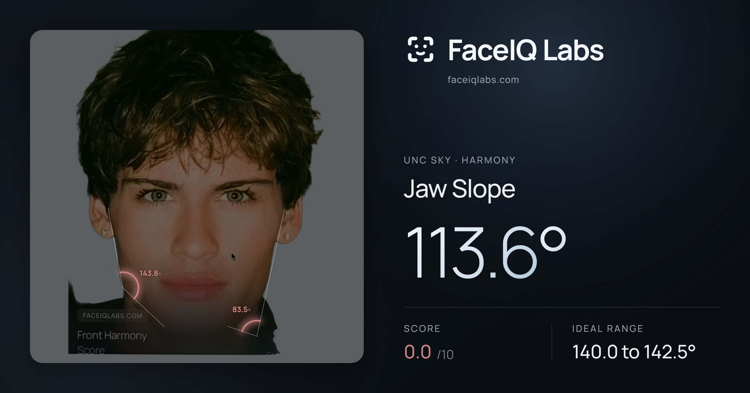 Unc Sky Jaw Slope: 110.3°, drawn on the photo