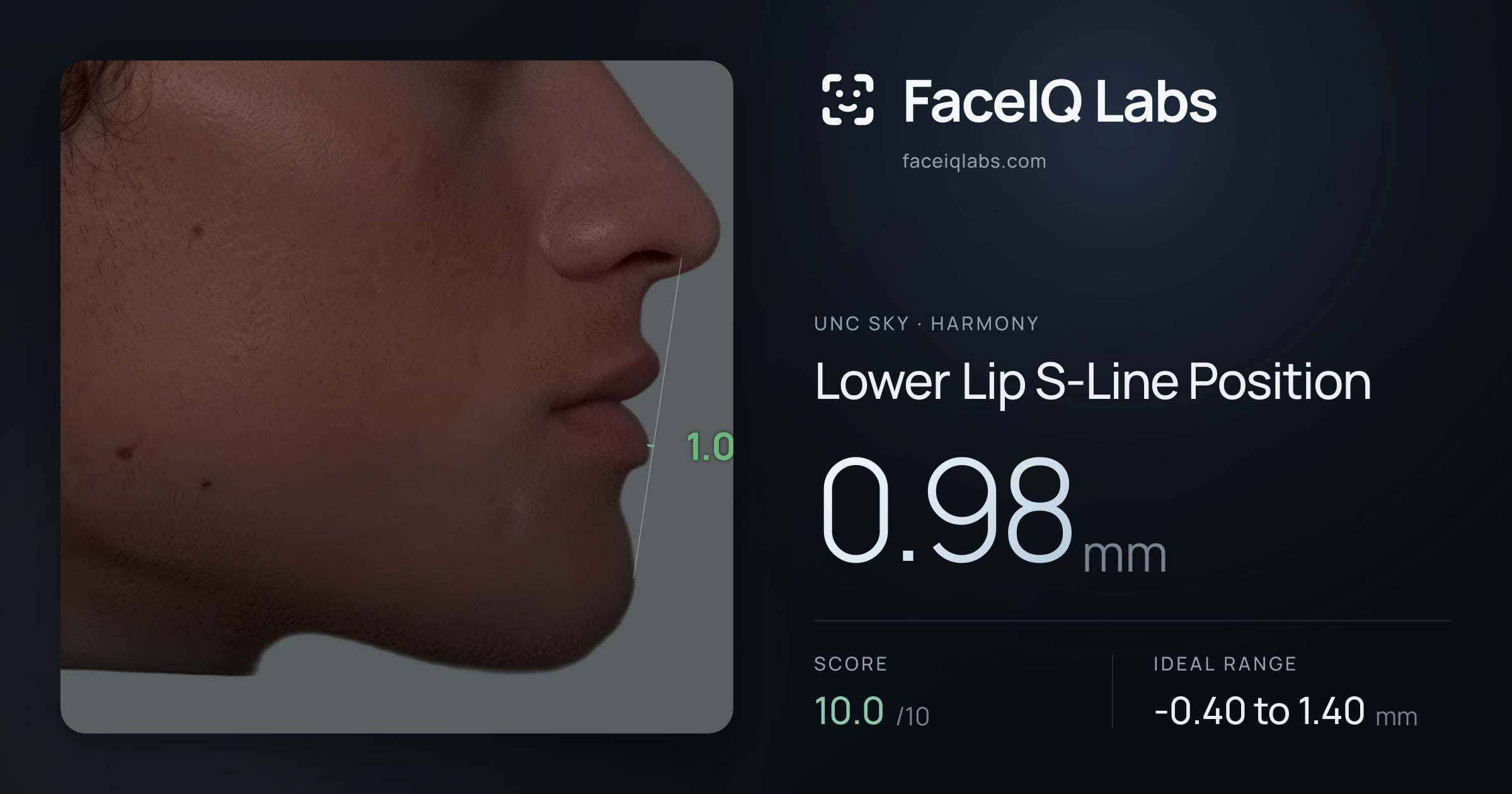 Unc Sky Lower Lip S-Line Position: 0.98mm, drawn on the photo