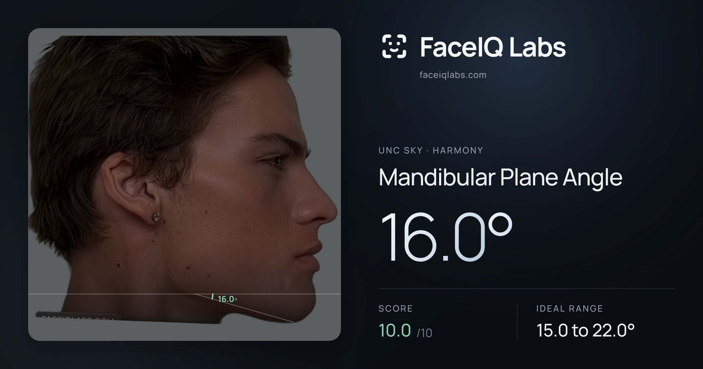 Unc Sky Mandibular Plane Angle: 16.0°, drawn on the photo