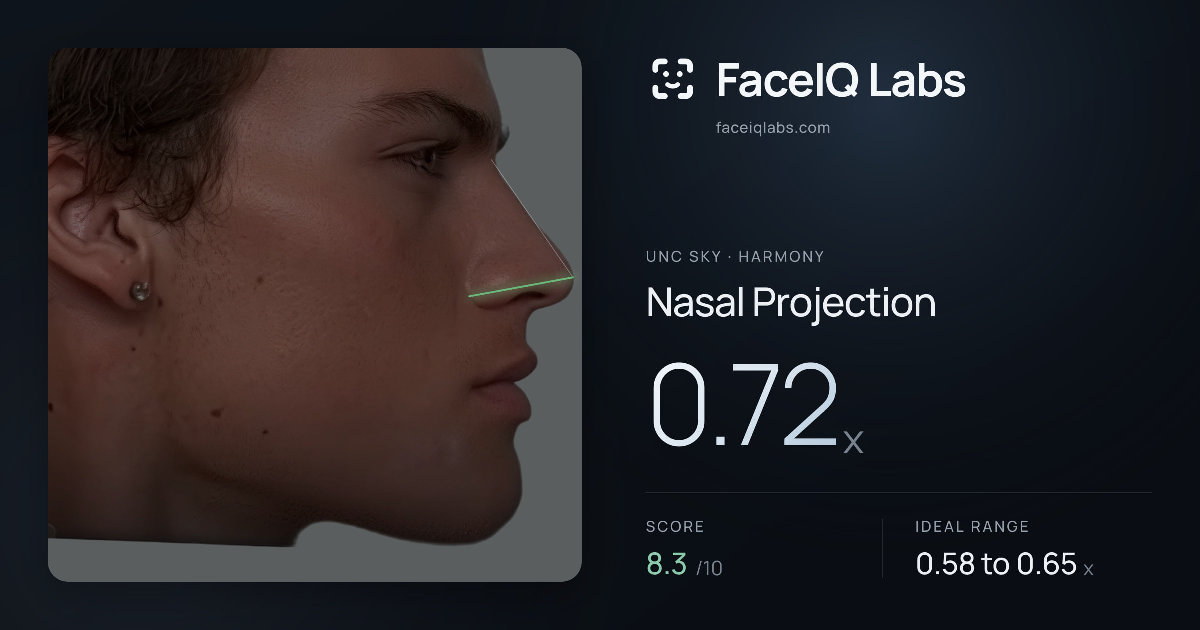 Unc Sky Nasal Projection: 0.72x, drawn on the photo