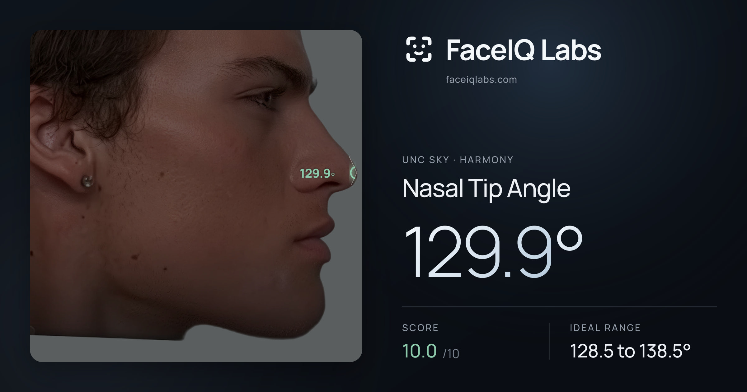 Unc Sky Nasal Tip Angle: 129.9°, drawn on the photo