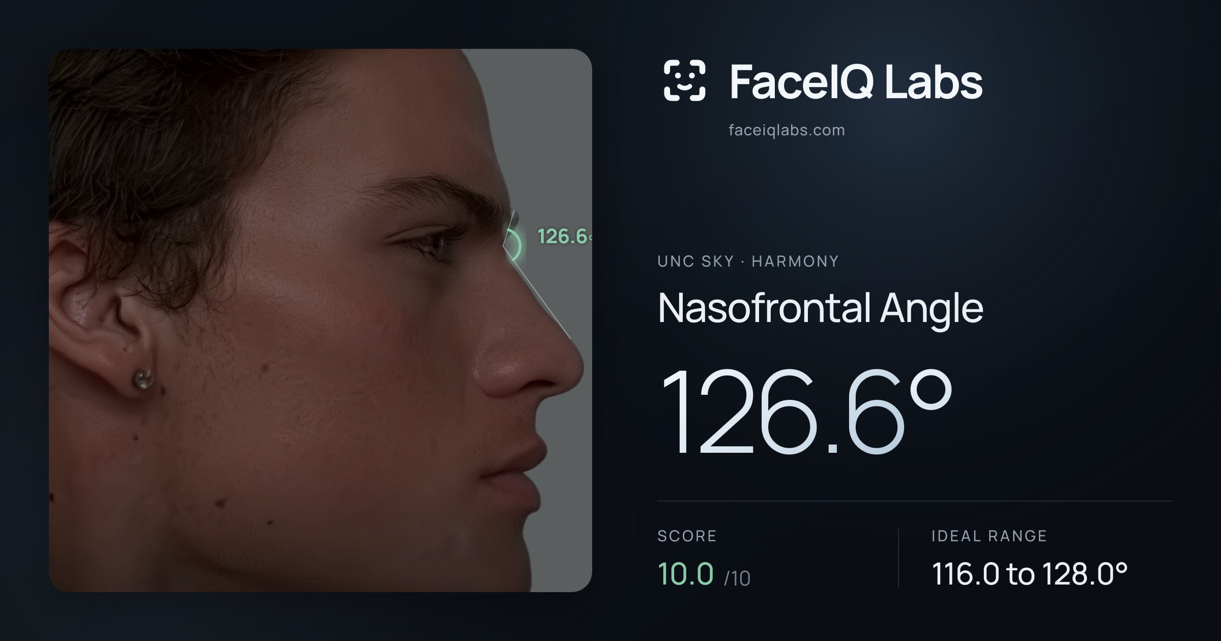 Unc Sky Nasofrontal Angle: 126.6°, drawn on the photo