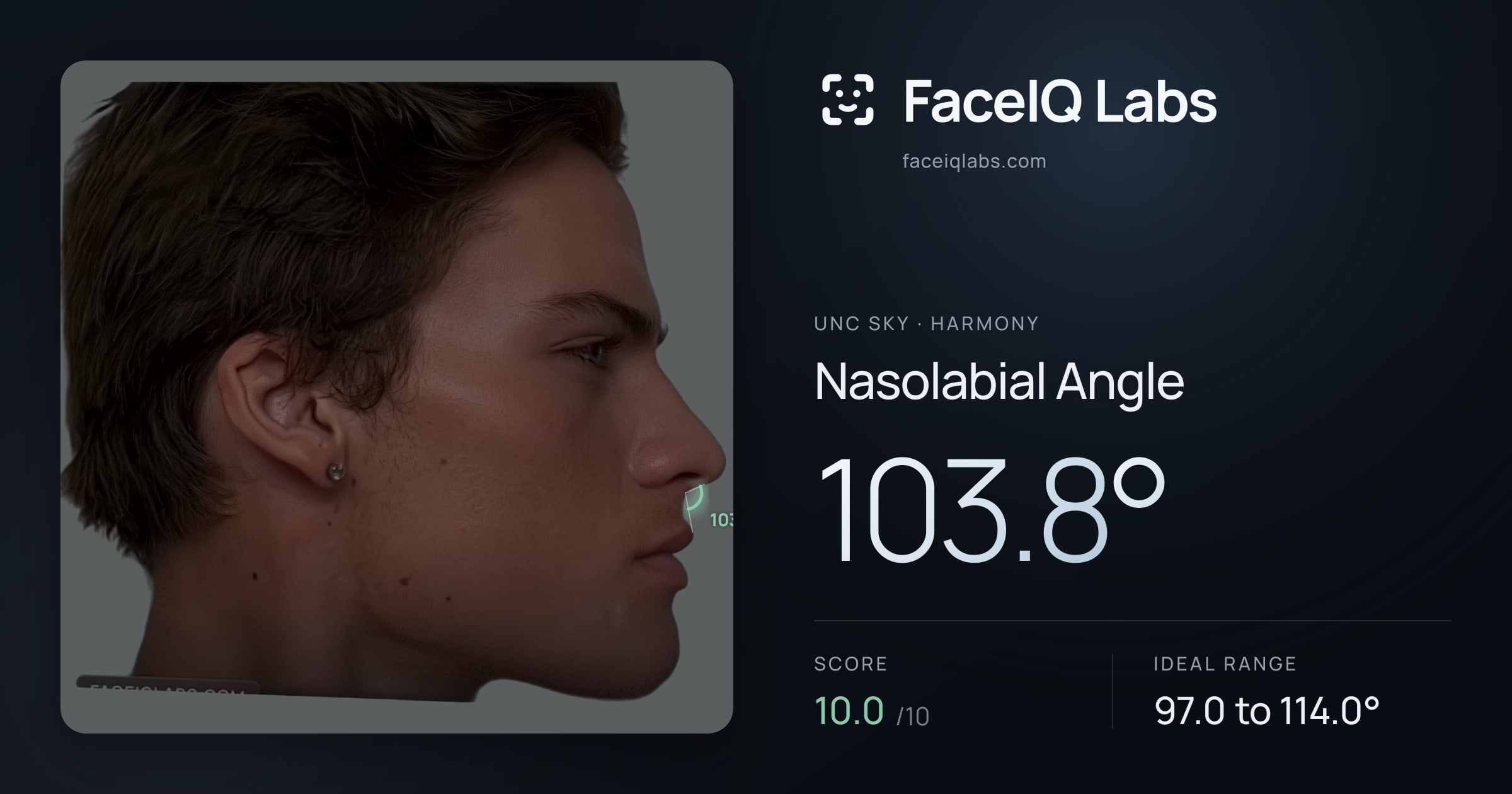 Unc Sky Nasolabial Angle: 103.8°, drawn on the photo