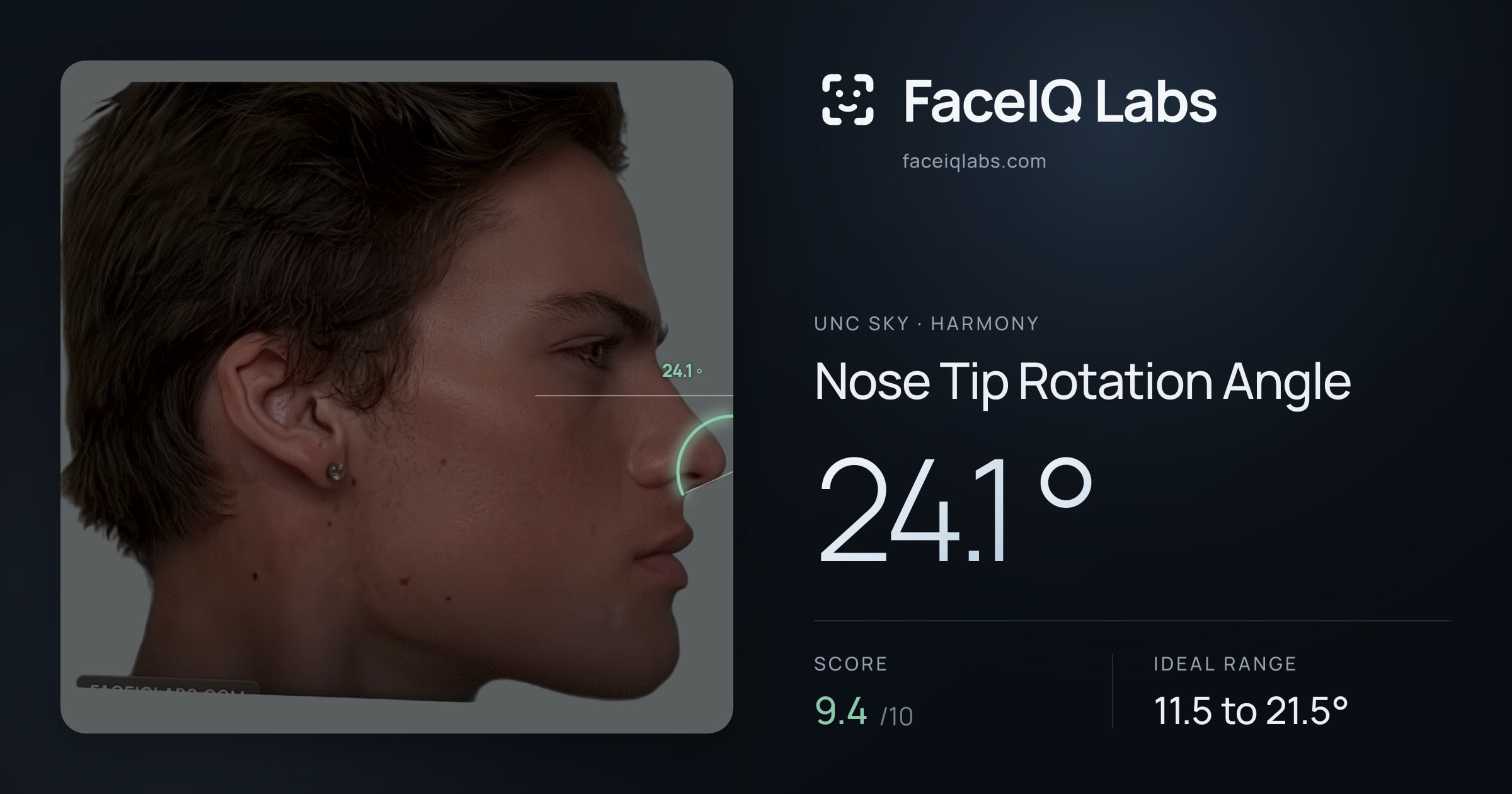 Unc Sky Nose Tip Rotation Angle: 24.1°, drawn on the photo