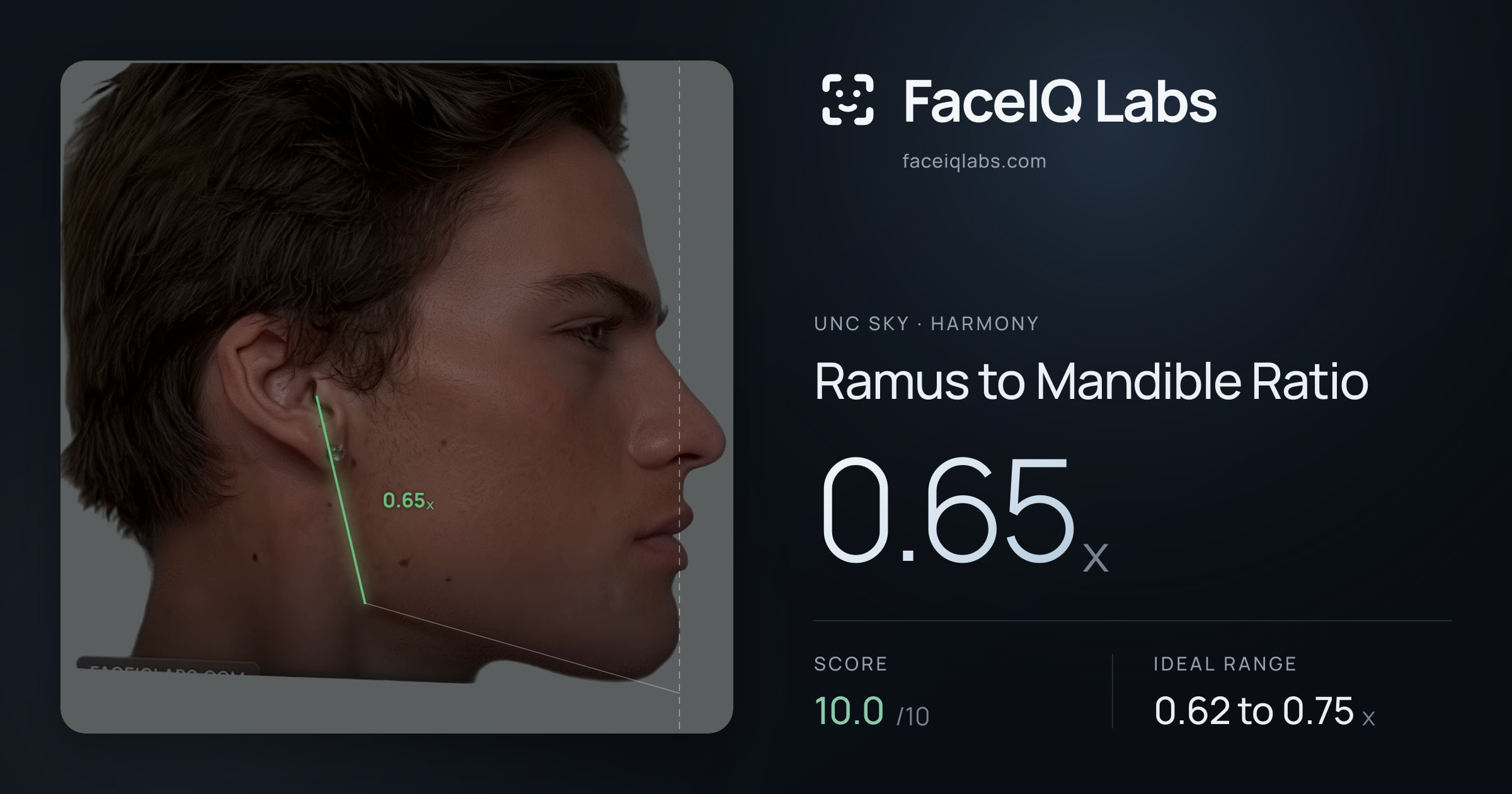 Unc Sky Ramus to Mandible Ratio: 0.65x, drawn on the photo