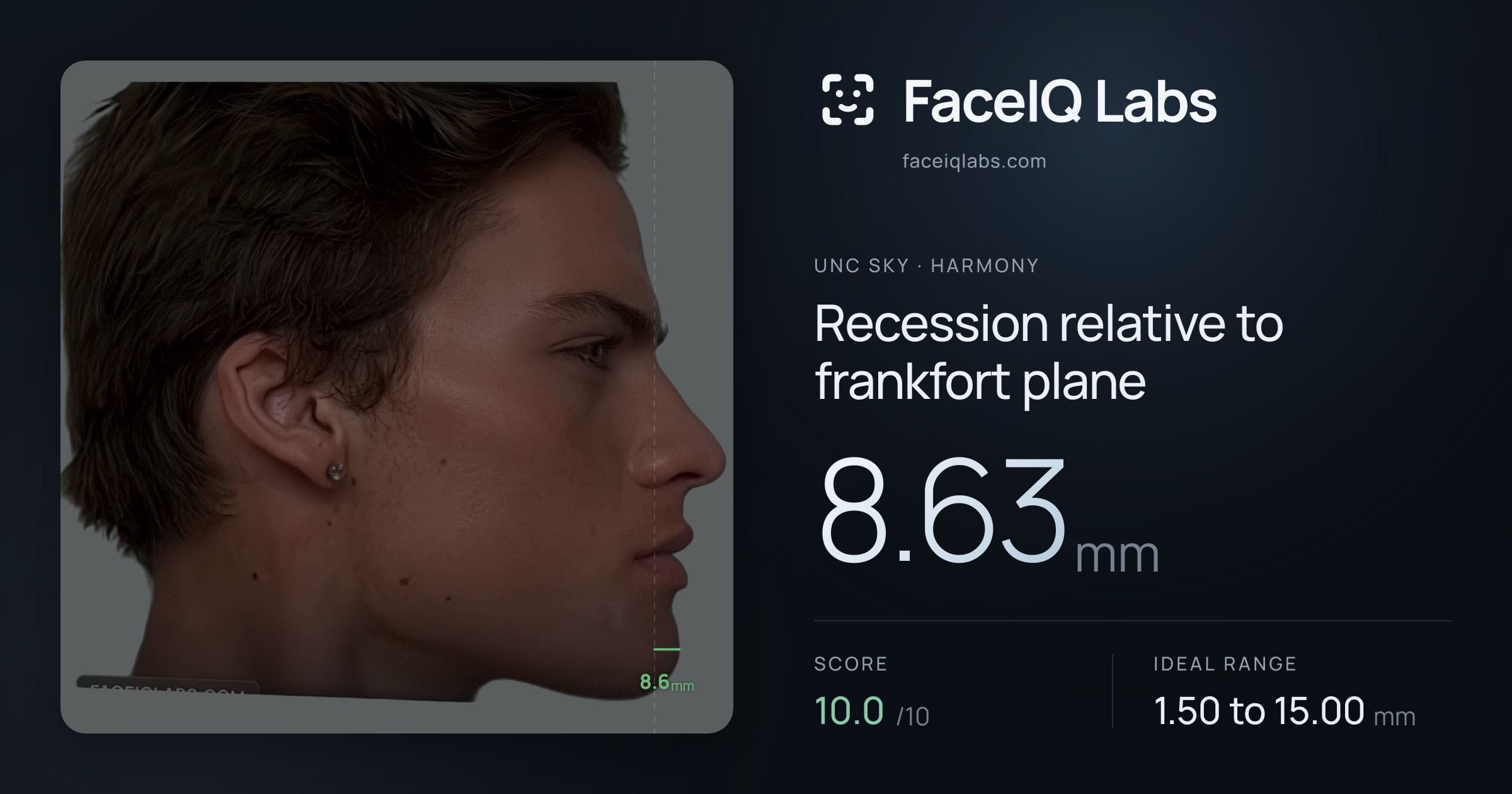 Unc Sky Recession relative to frankfort plane: 8.63mm, drawn on the photo