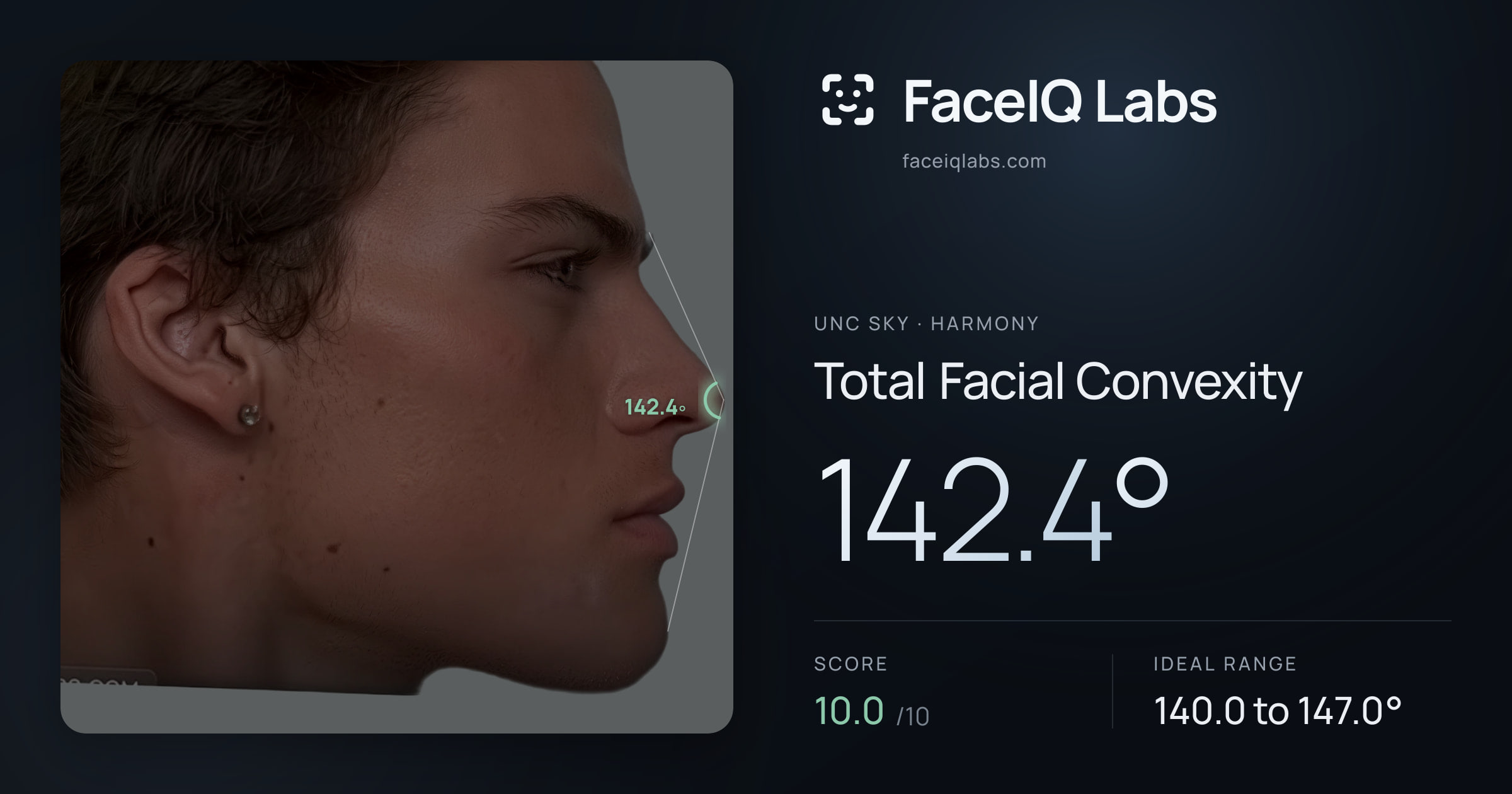 Unc Sky Total Facial Convexity: 142.4°, drawn on the photo