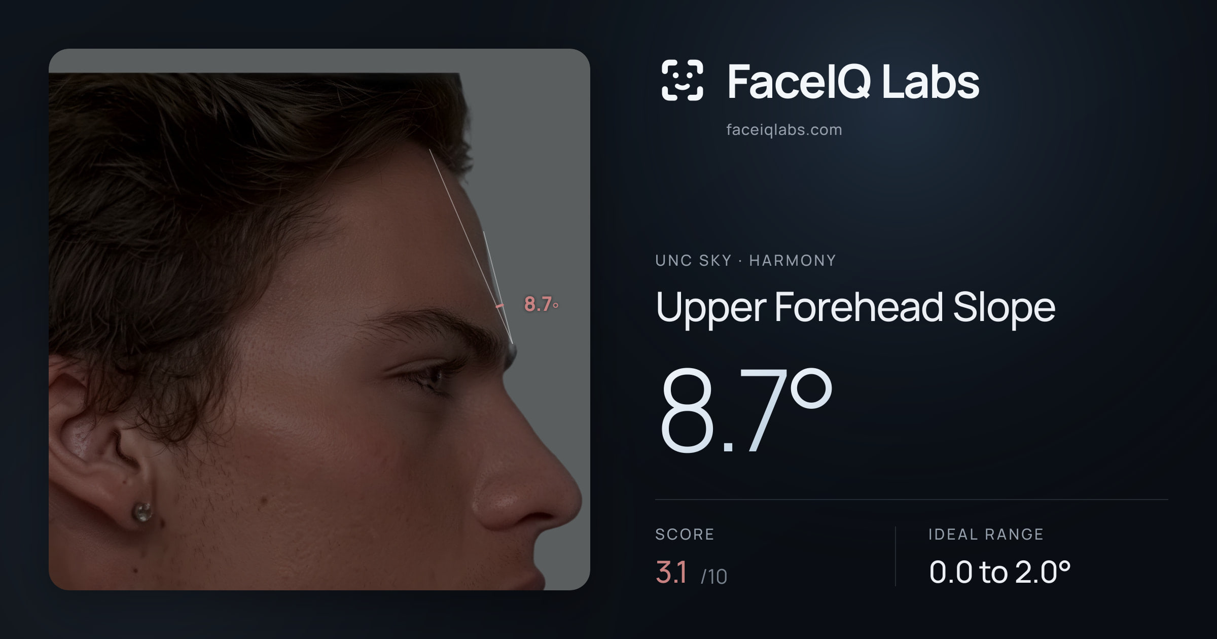 Unc Sky Upper Forehead Slope: 8.7°, drawn on the photo