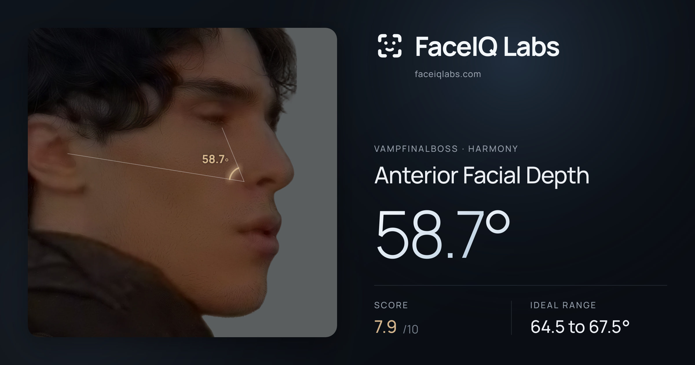 Vampfinalboss Anterior Facial Depth: 58.7°, drawn on the photo